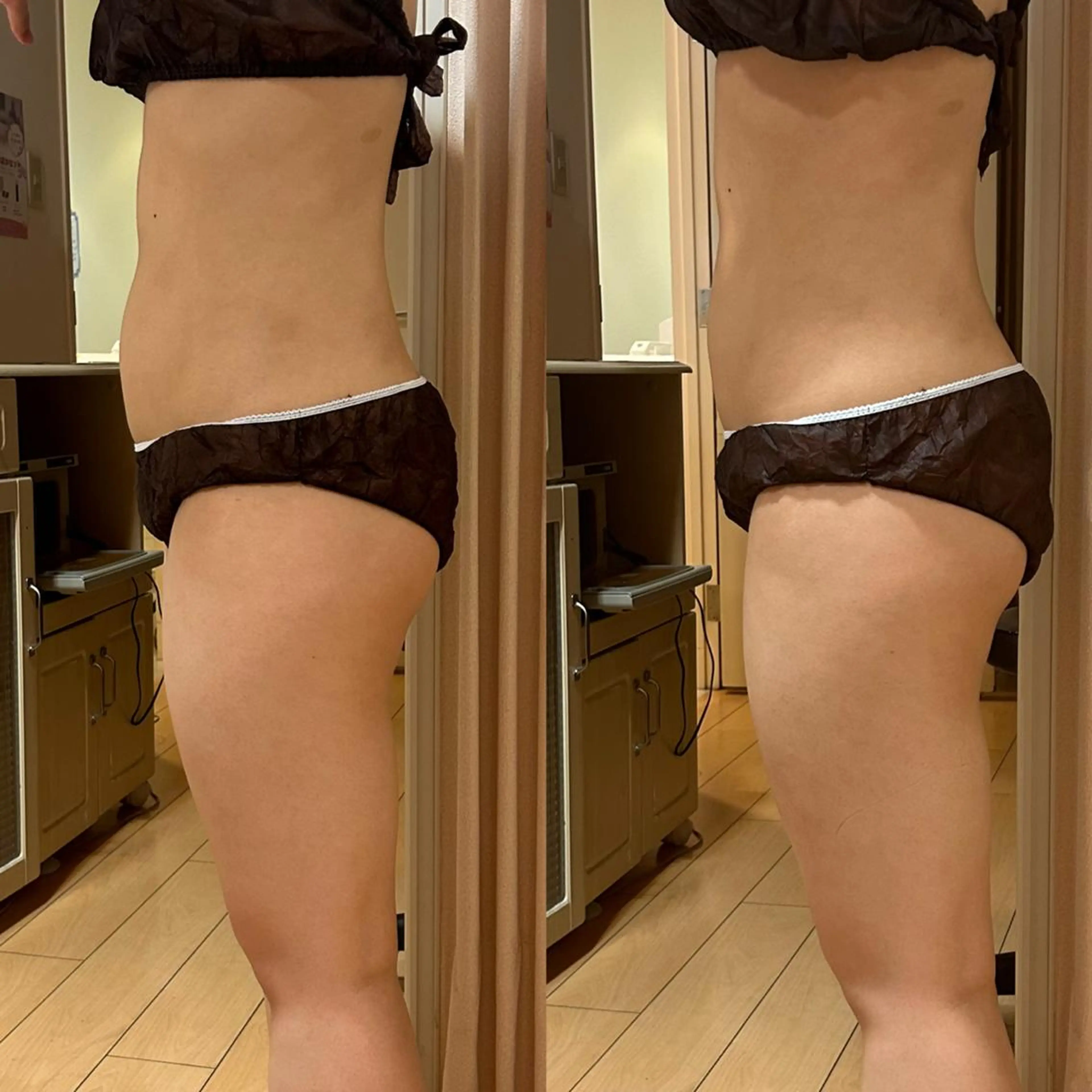 エステ バスト専門店 RAYVIS木島🌺のエステ・リラクイメージ