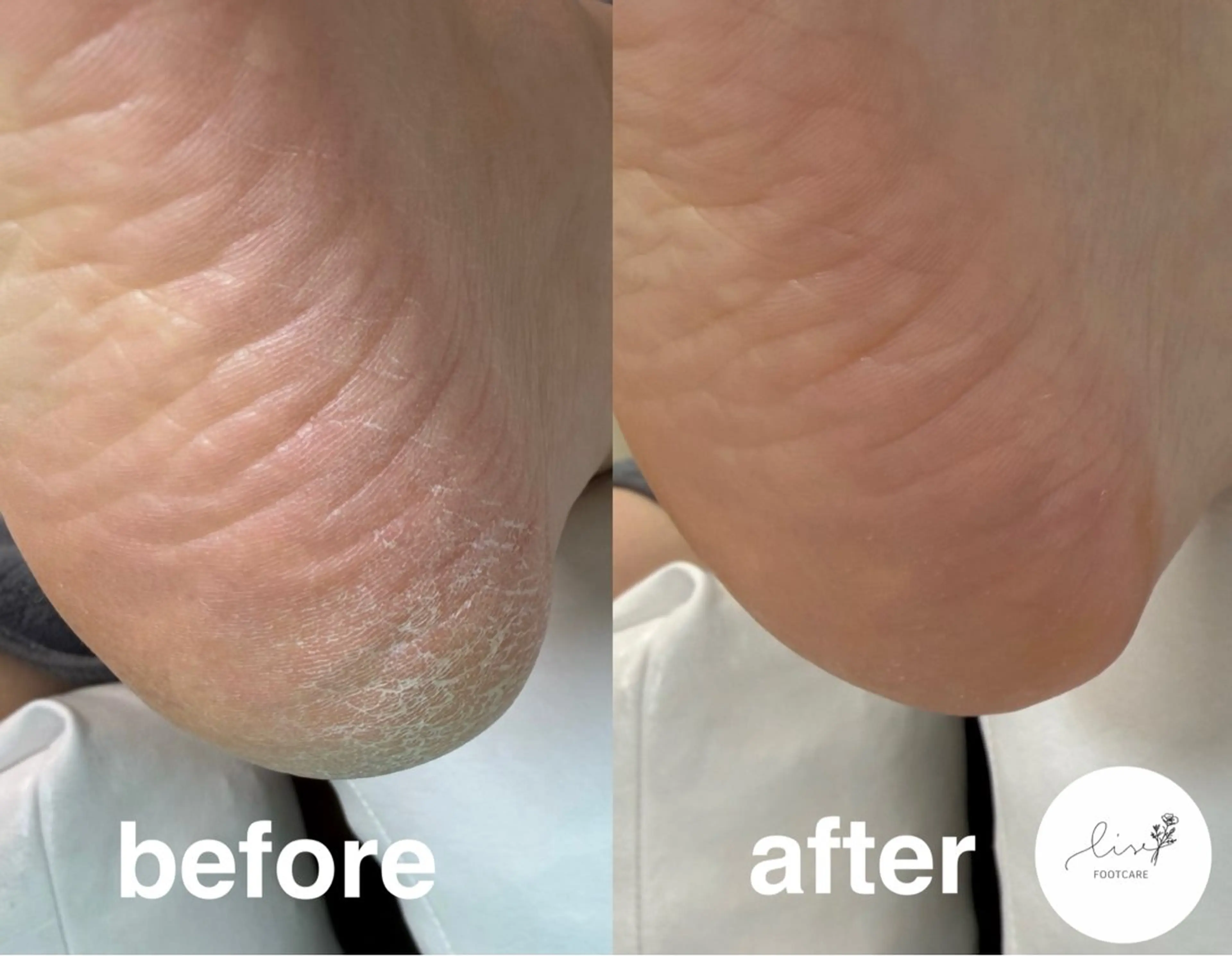 Lise footcareのネイルデザイン