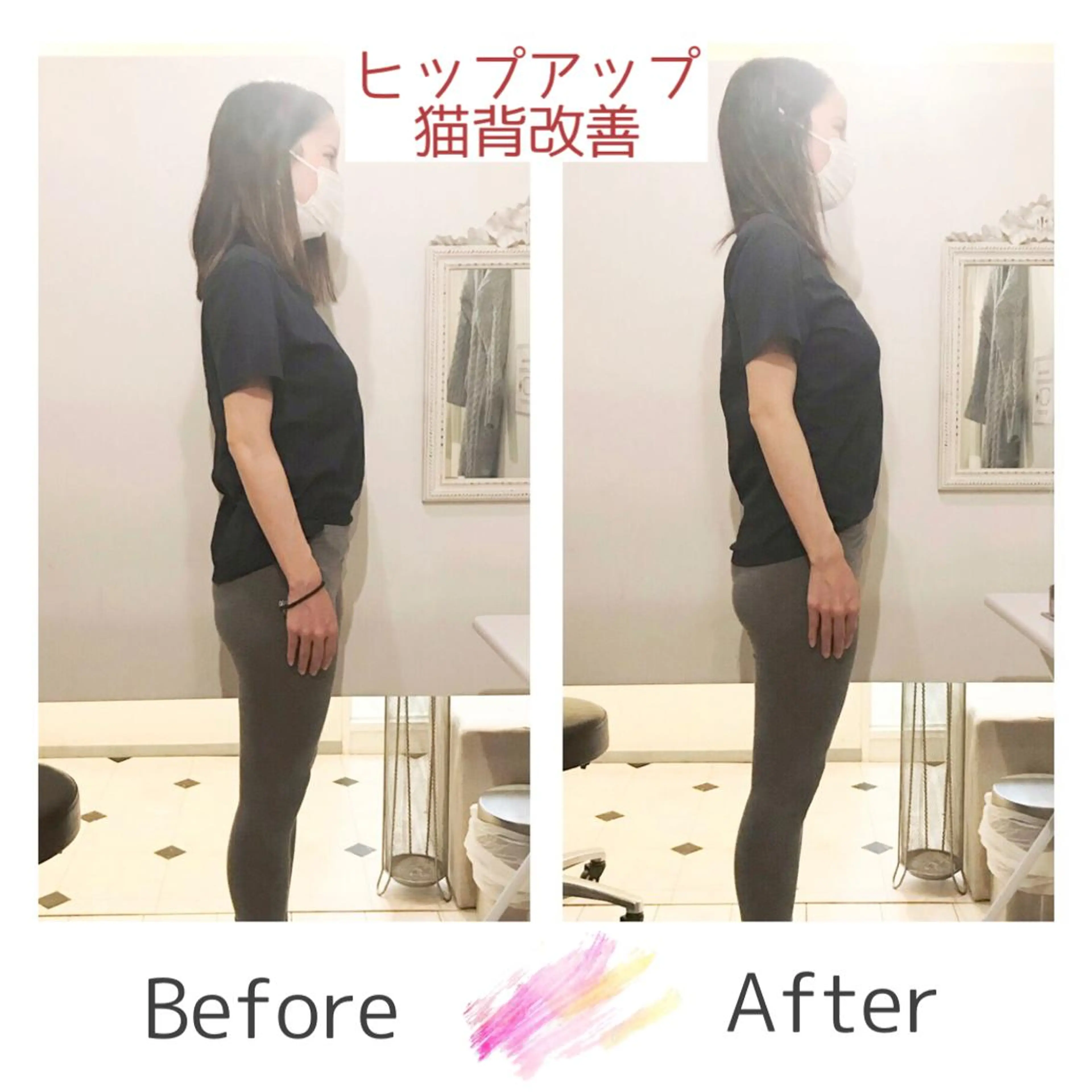 小顔モニター 募集のエステ・リラクイメージ