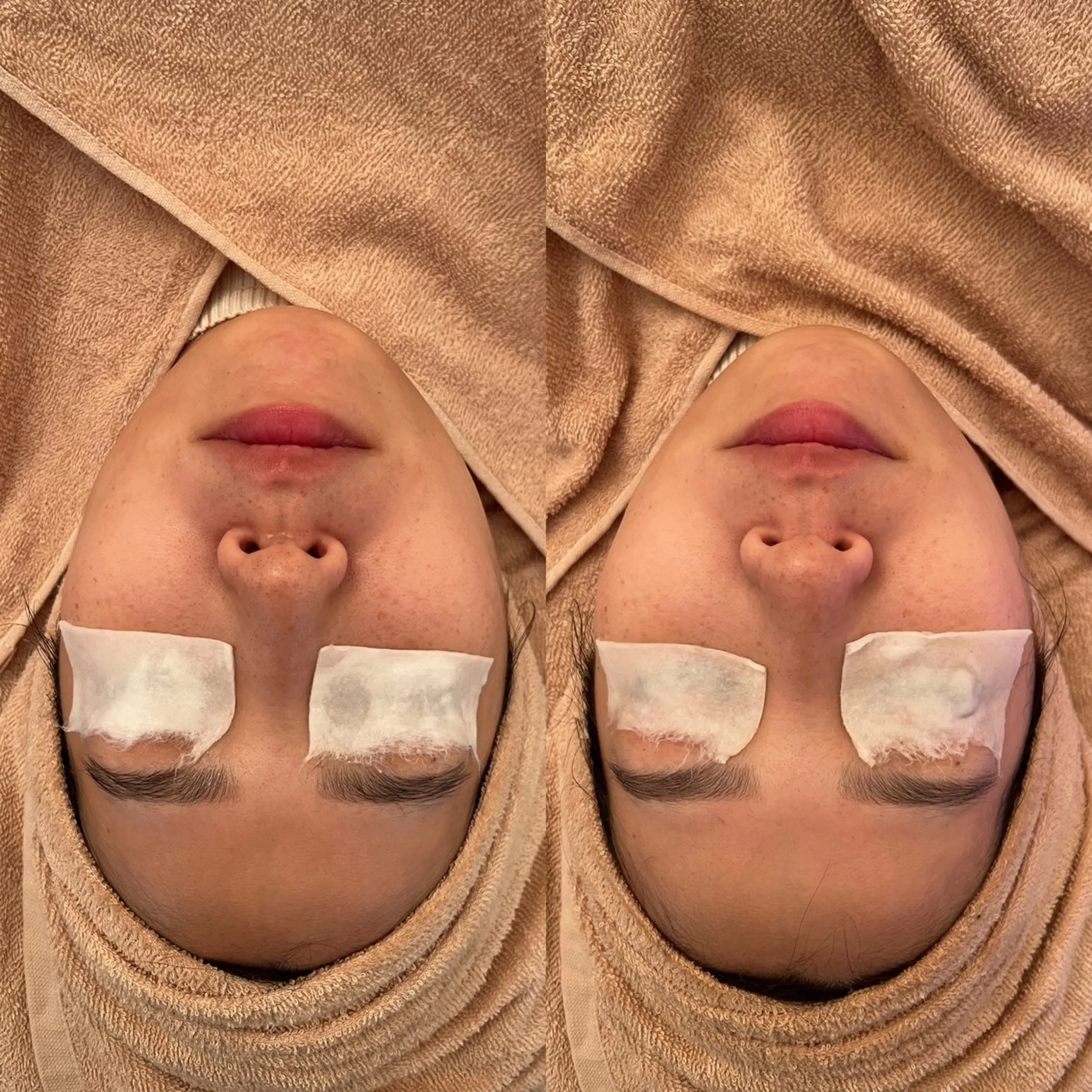 毛穴ケア/毛穴診断/ 毛穴洗浄〔心斎橋〕のエステ・リラクイメージ