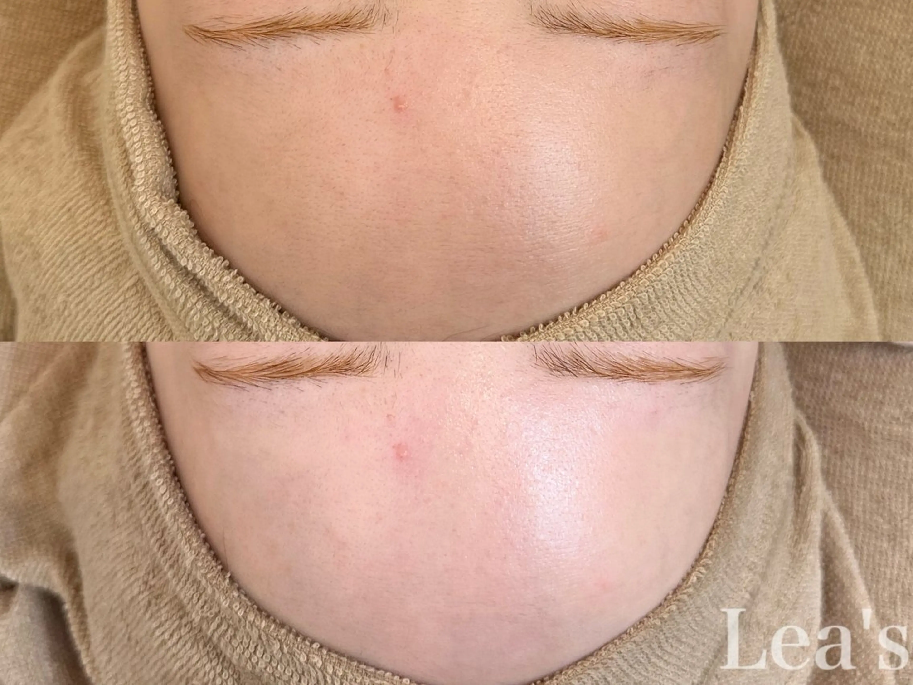 Lea's所属・【Lea's 】 hazukiのエステ・リラクイメージ