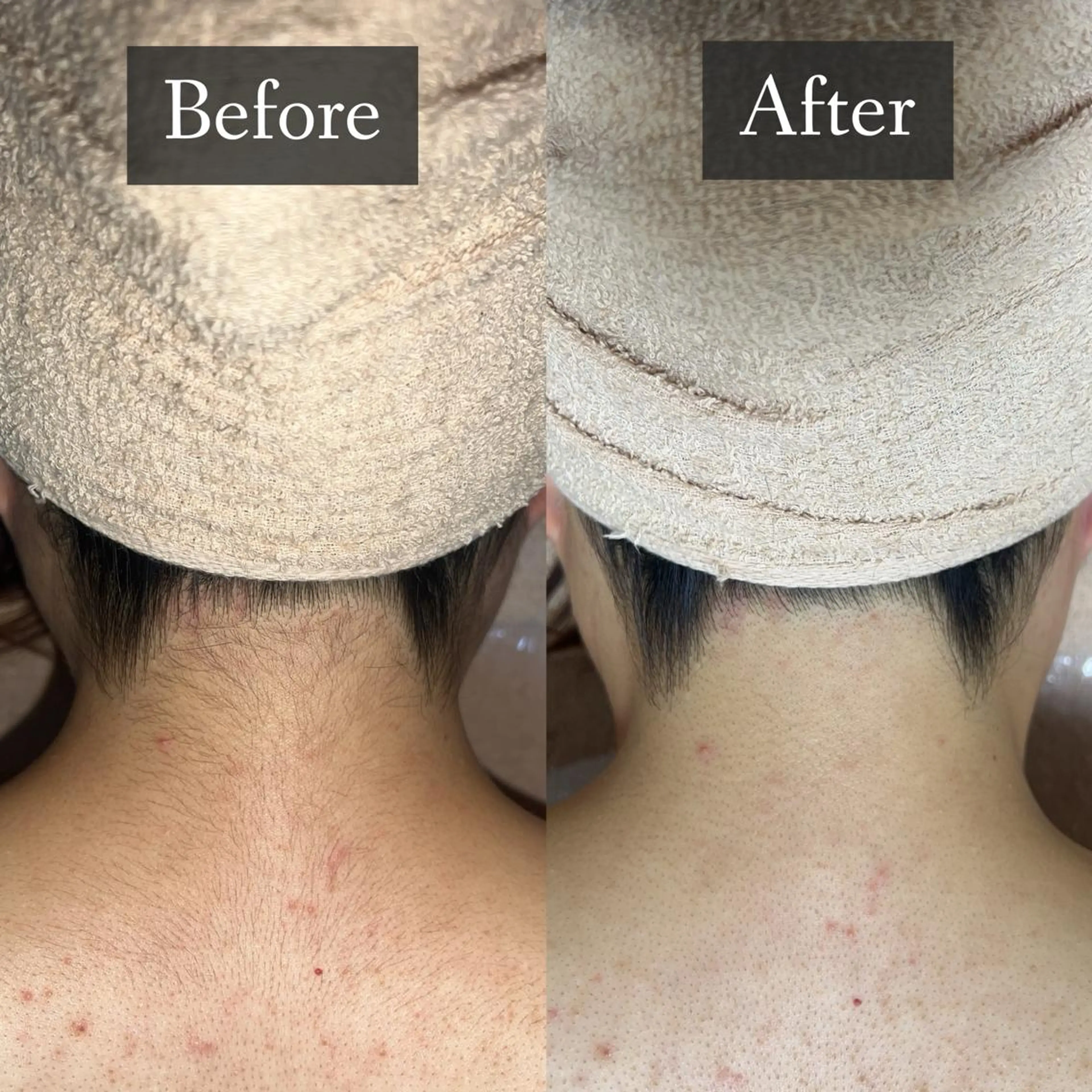 脱毛 脱毛専門サロン BELFINE恵比寿のエステ・リラクイメージ