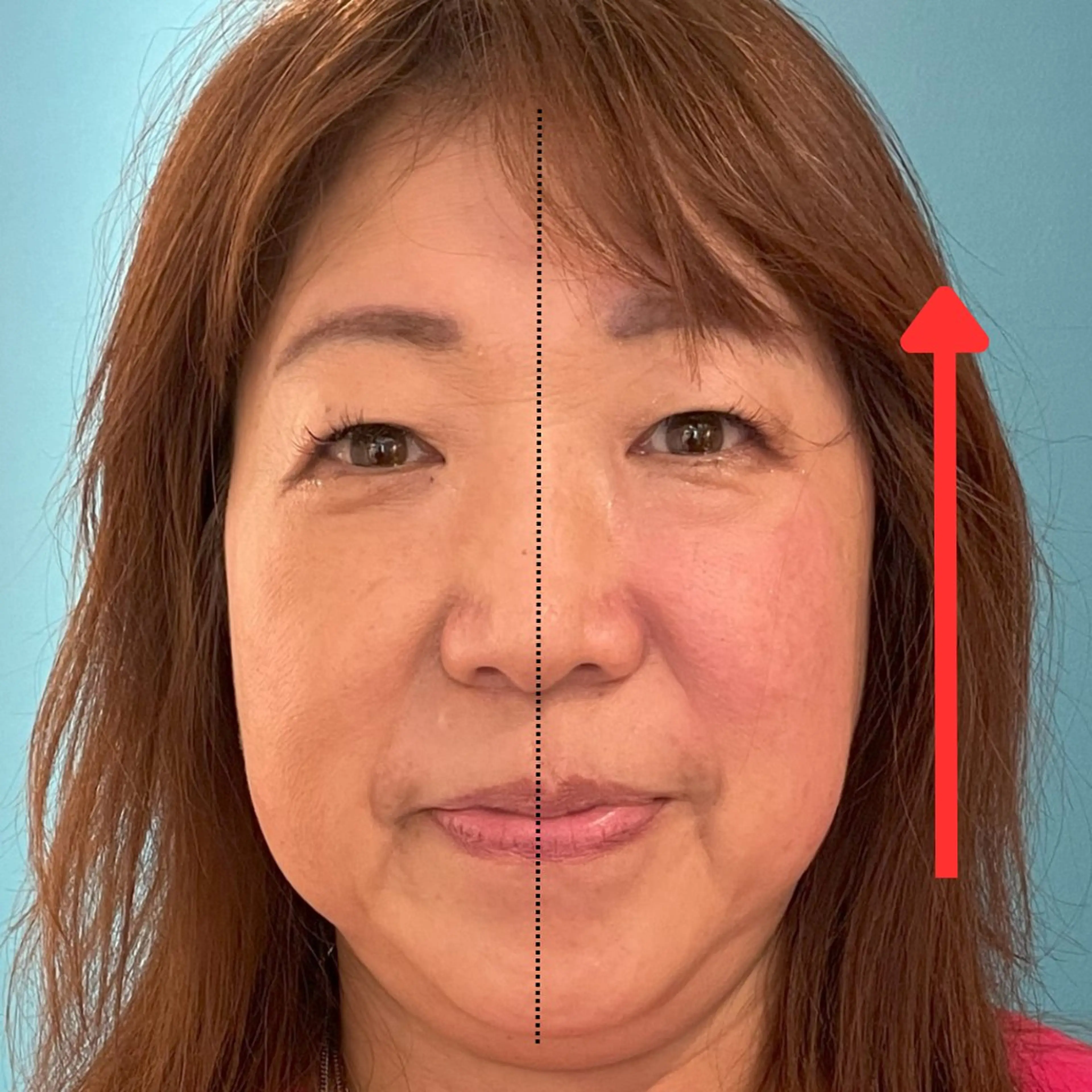 エステ リラク Nexfit for Beauty小顔矯正のエステ・リラクイメージ