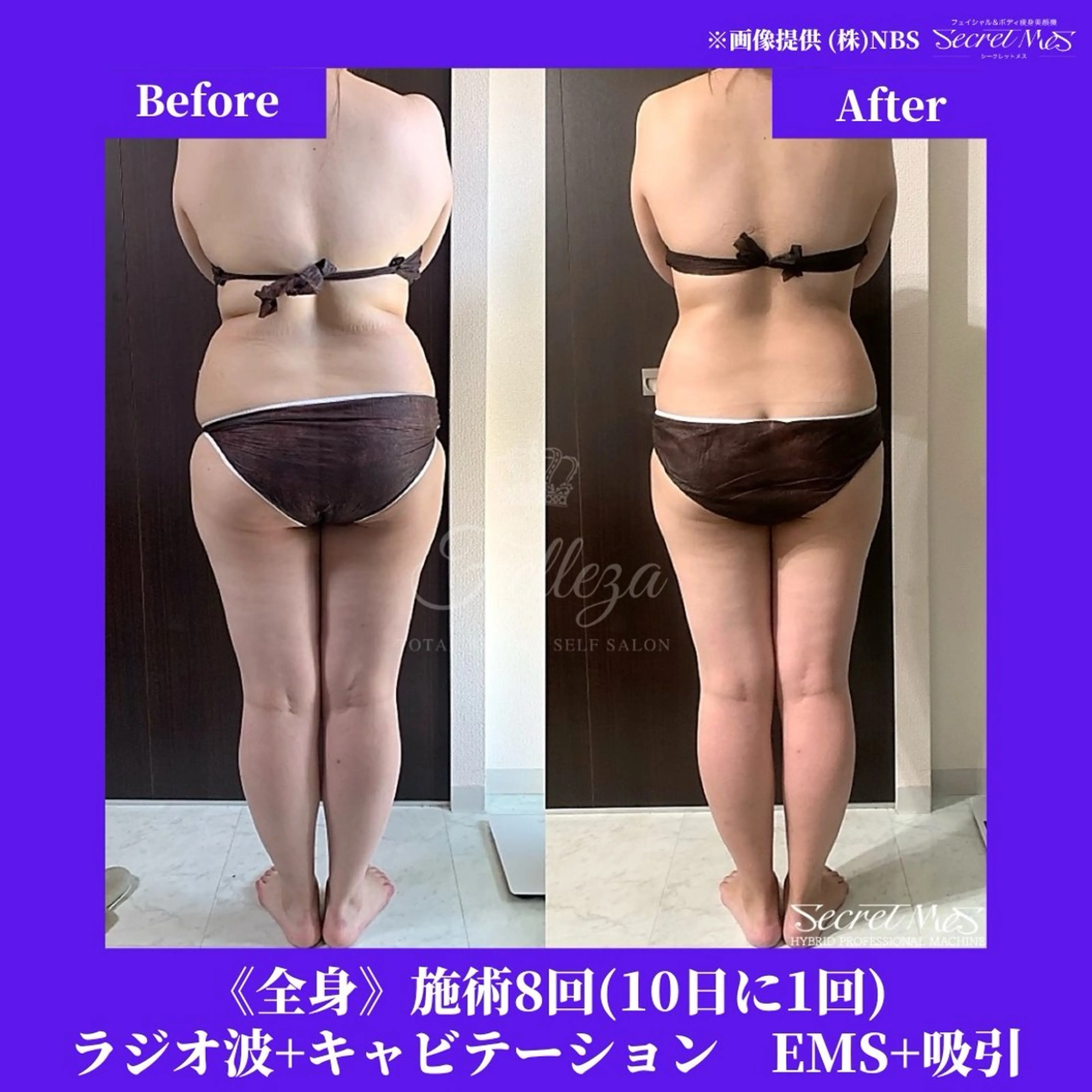 メンズ 有人型セルフサロン 脱毛／痩身／美顔のその他イメージ