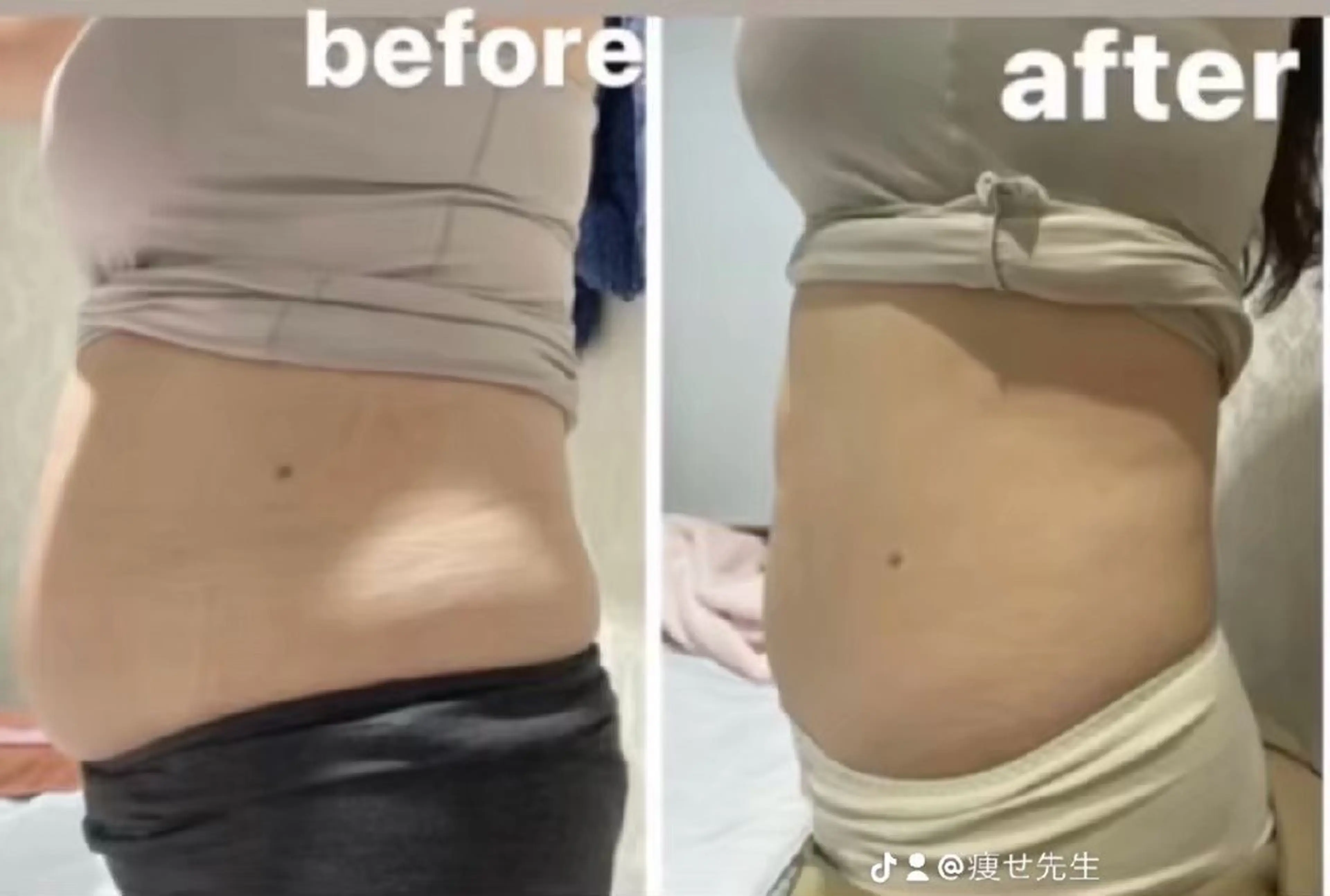 [デトックス瘦身] 最高峰-12°C冷却瘦身<高周 波x次世代EMSx酵素ドリンクの写真