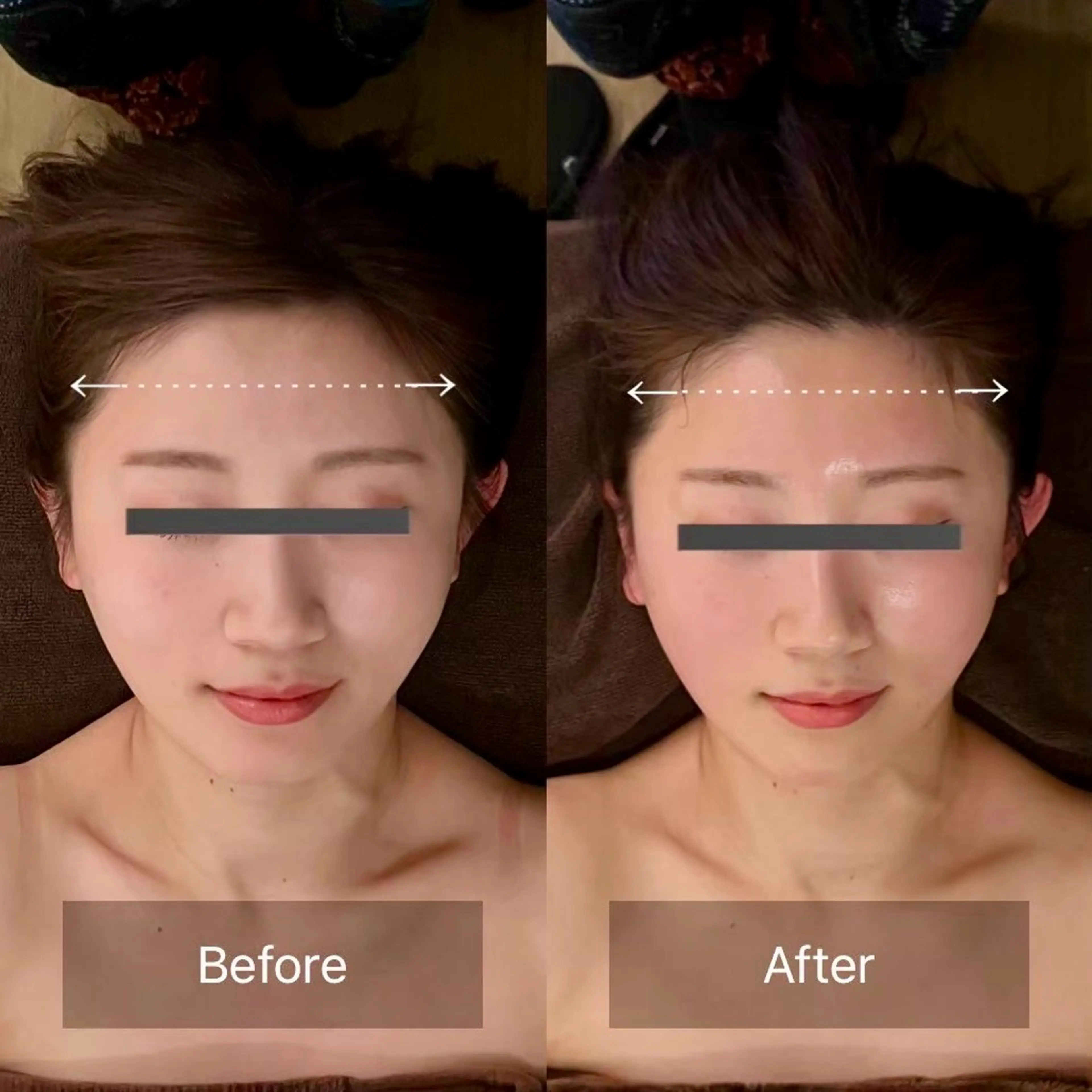 その他 Linoas所属・kogao&head Linoasのエステ・リラクイメージ