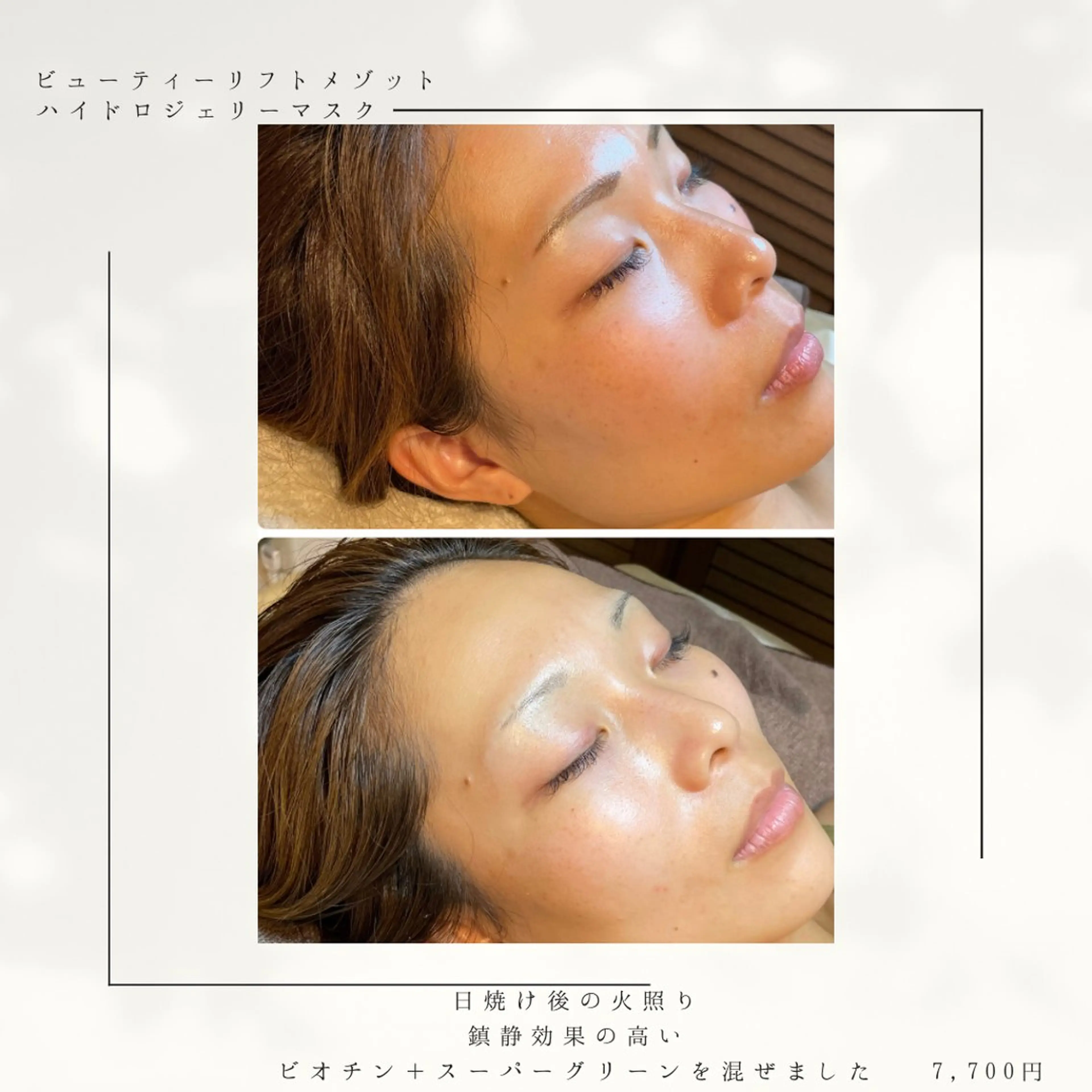 代表 MOMOのエステ・リラクイメージ