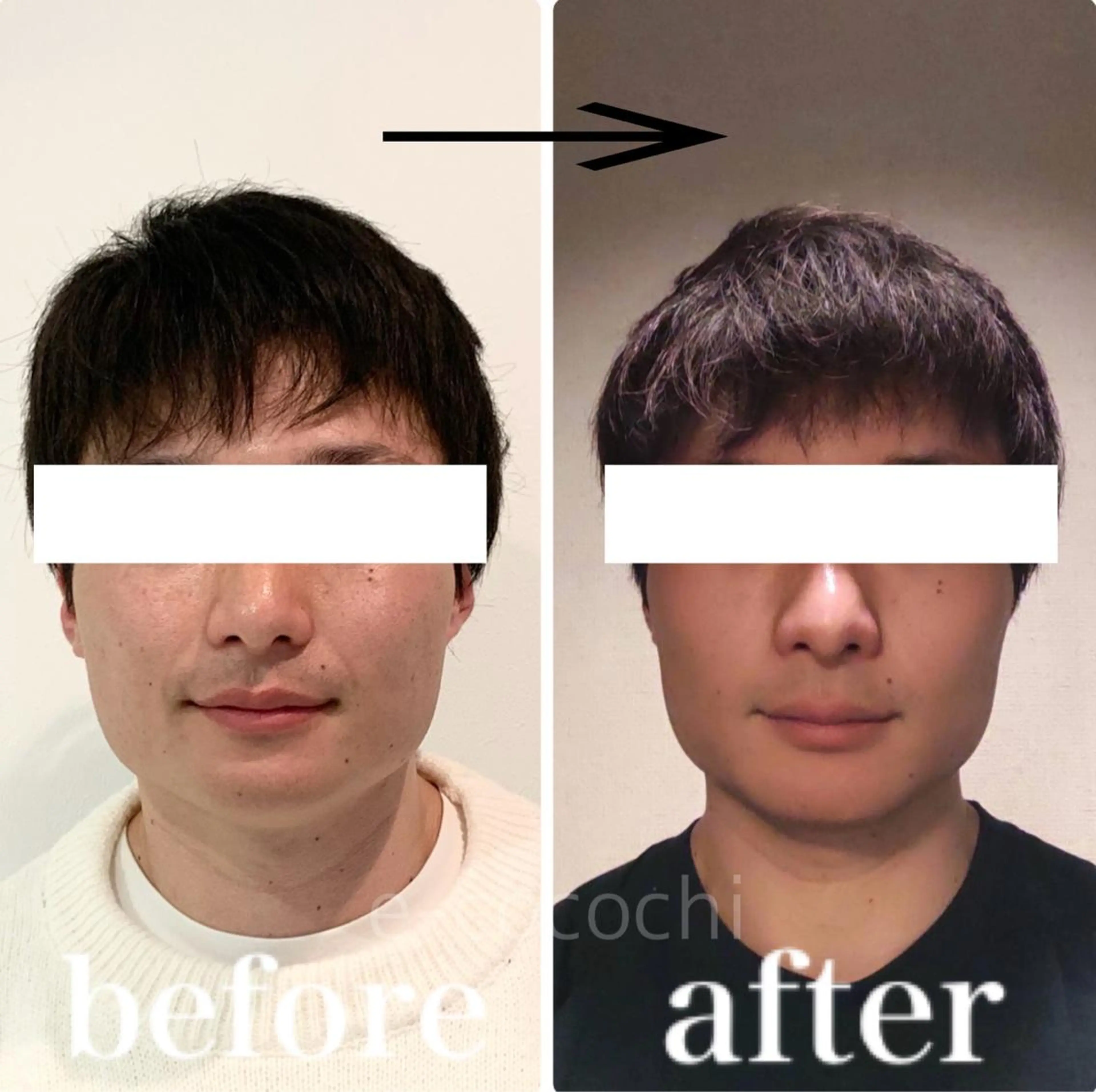 エステ リラク 小顔と ヘッドスパのお店のエステ・リラクイメージ