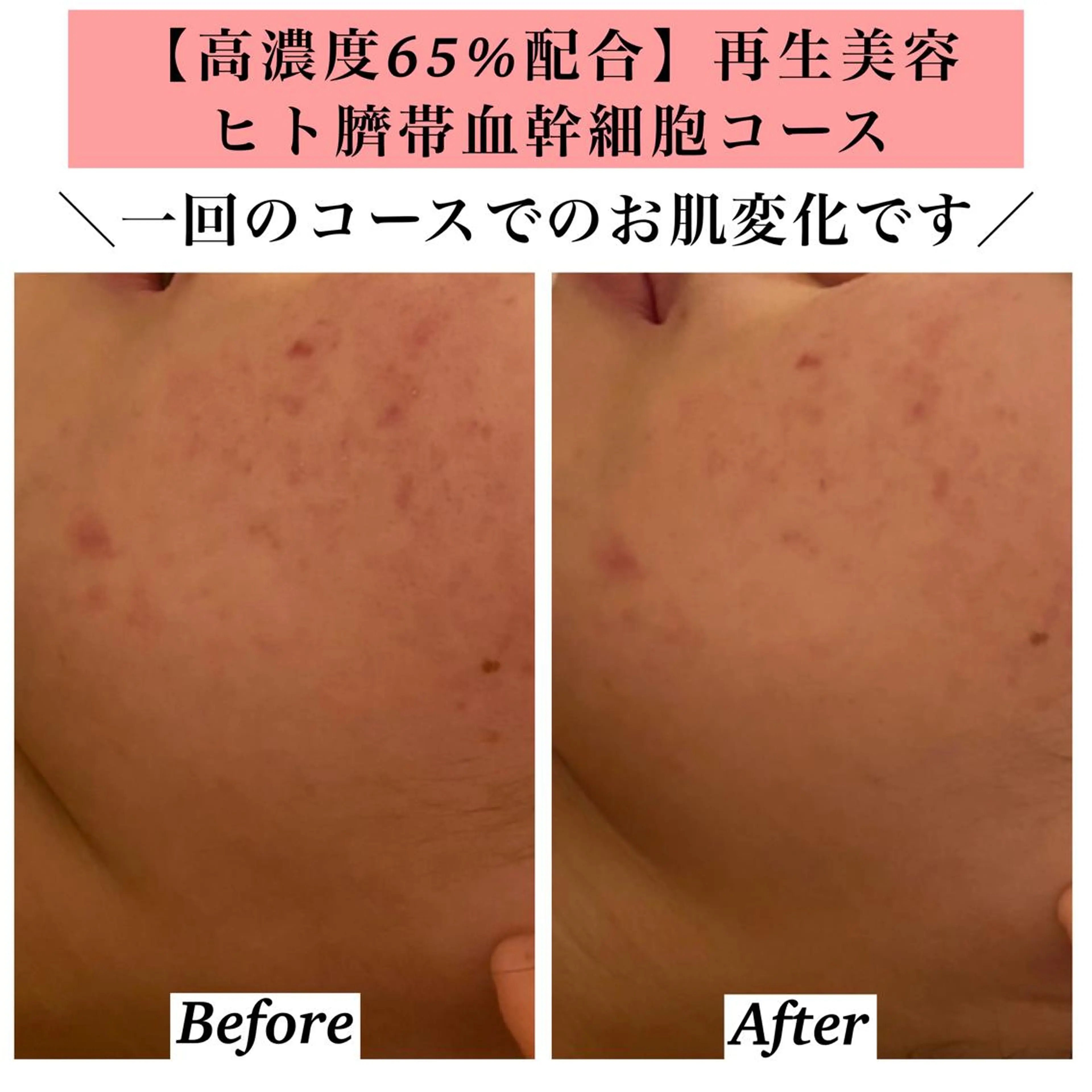 エステ リラク Bellesthe （ベルエステ）のエステ・リラクイメージ