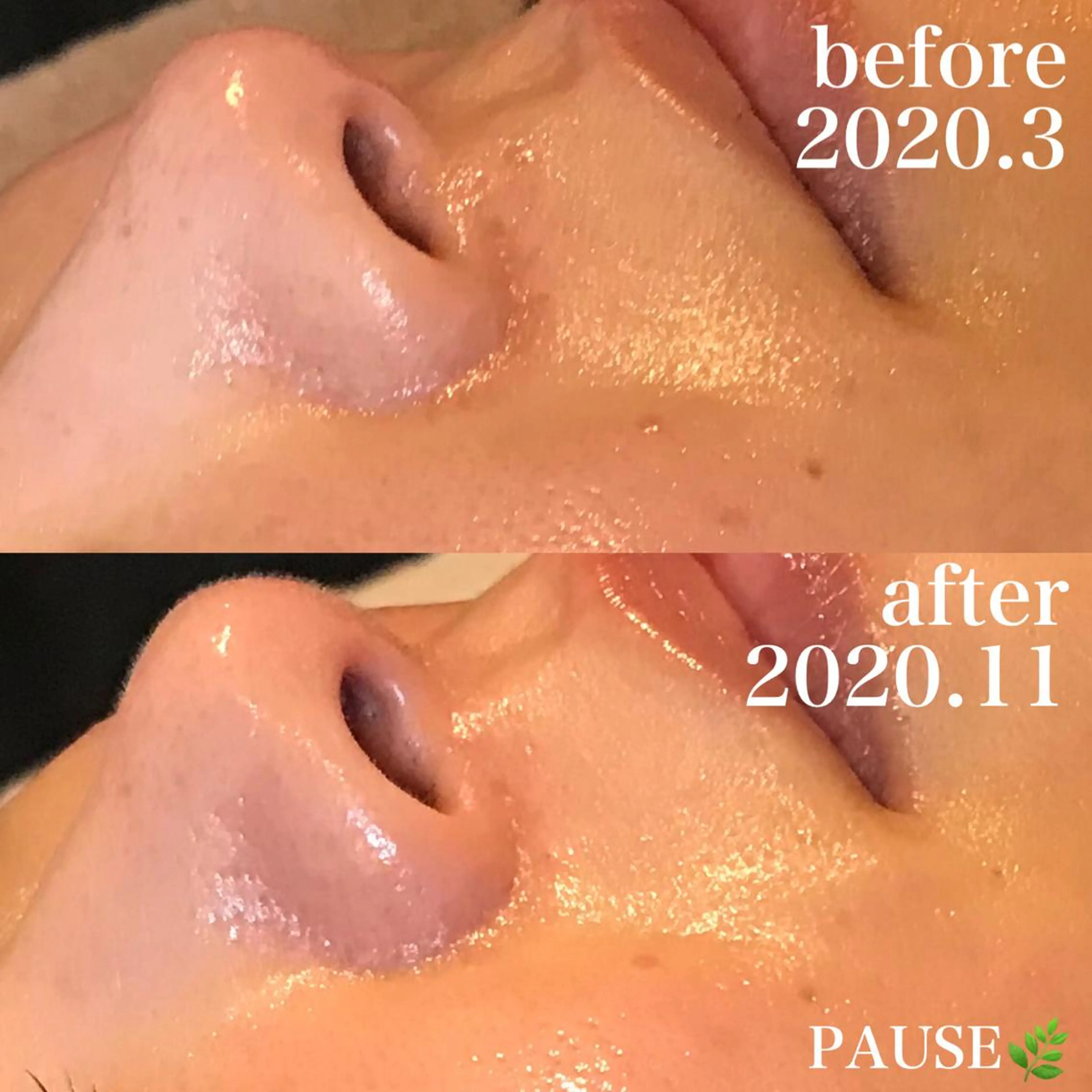 エステ 浜野 恵美のエステ・リラクイメージ