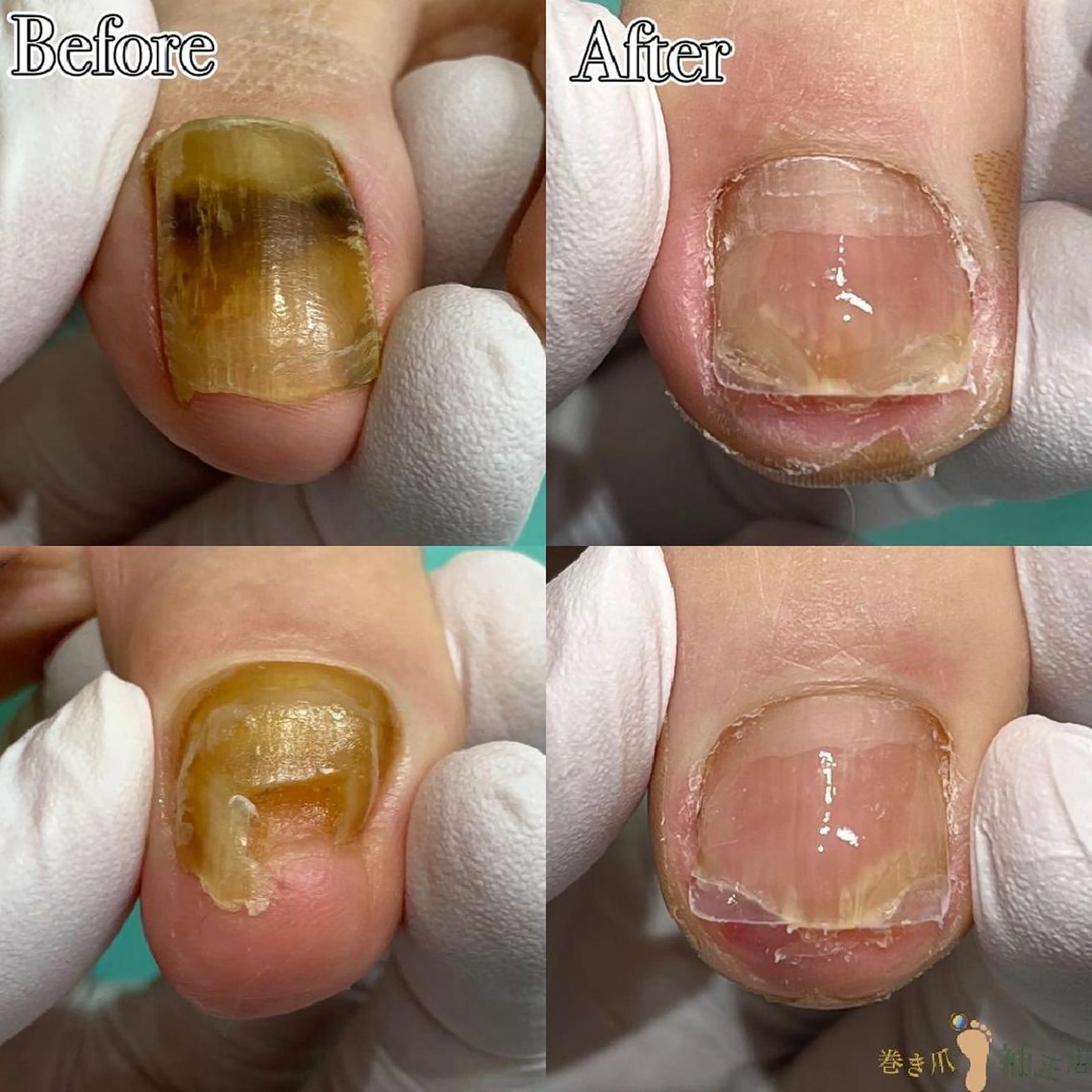 東京巻き爪アカデミー所属・東京巻き爪 アカデミーのエステ・リラクイメージ