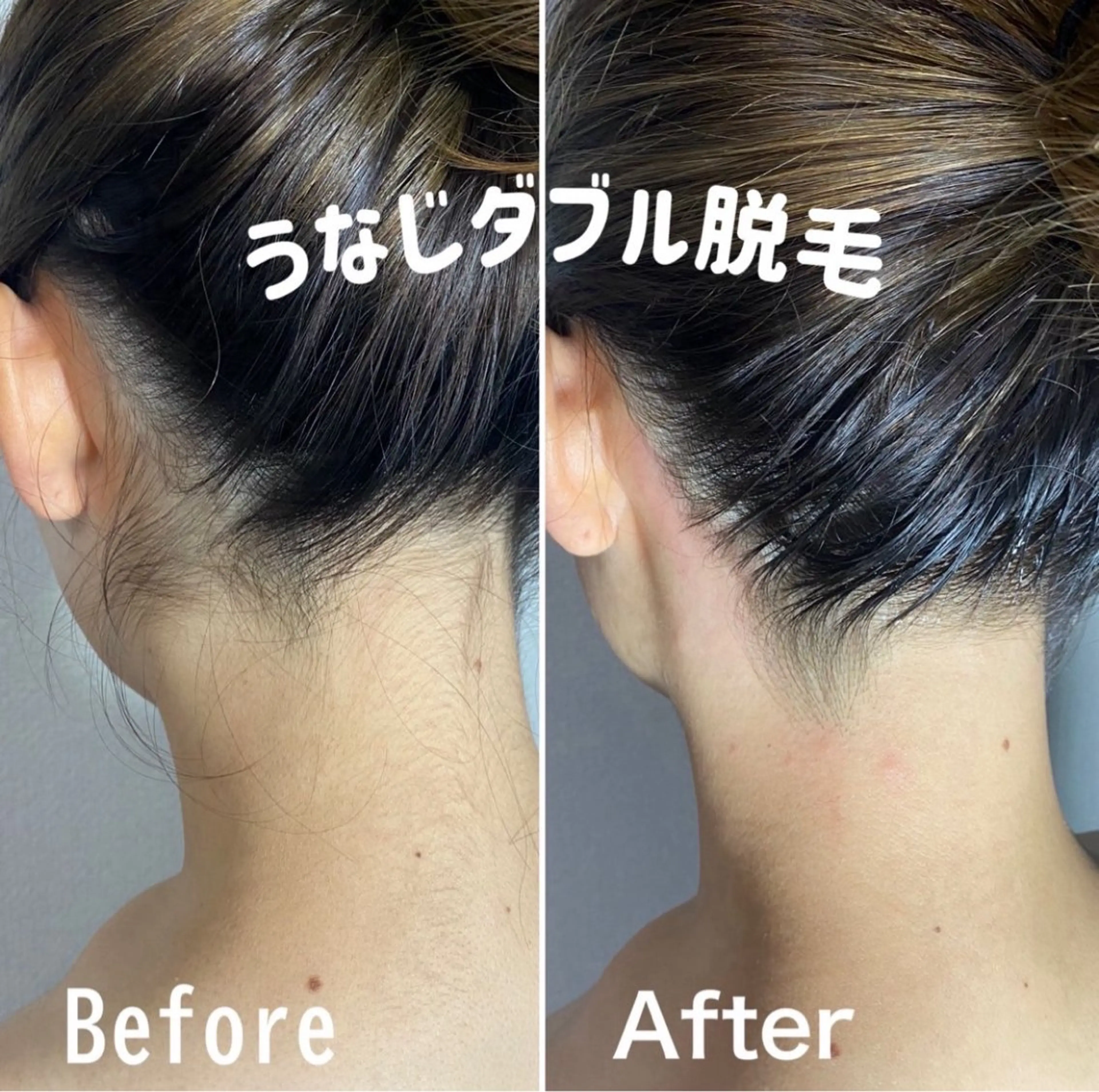 ブラジリアンワックス&美肌脱毛　エピナス大和店所属・エピナス 大和店のエステ・リラクイメージ