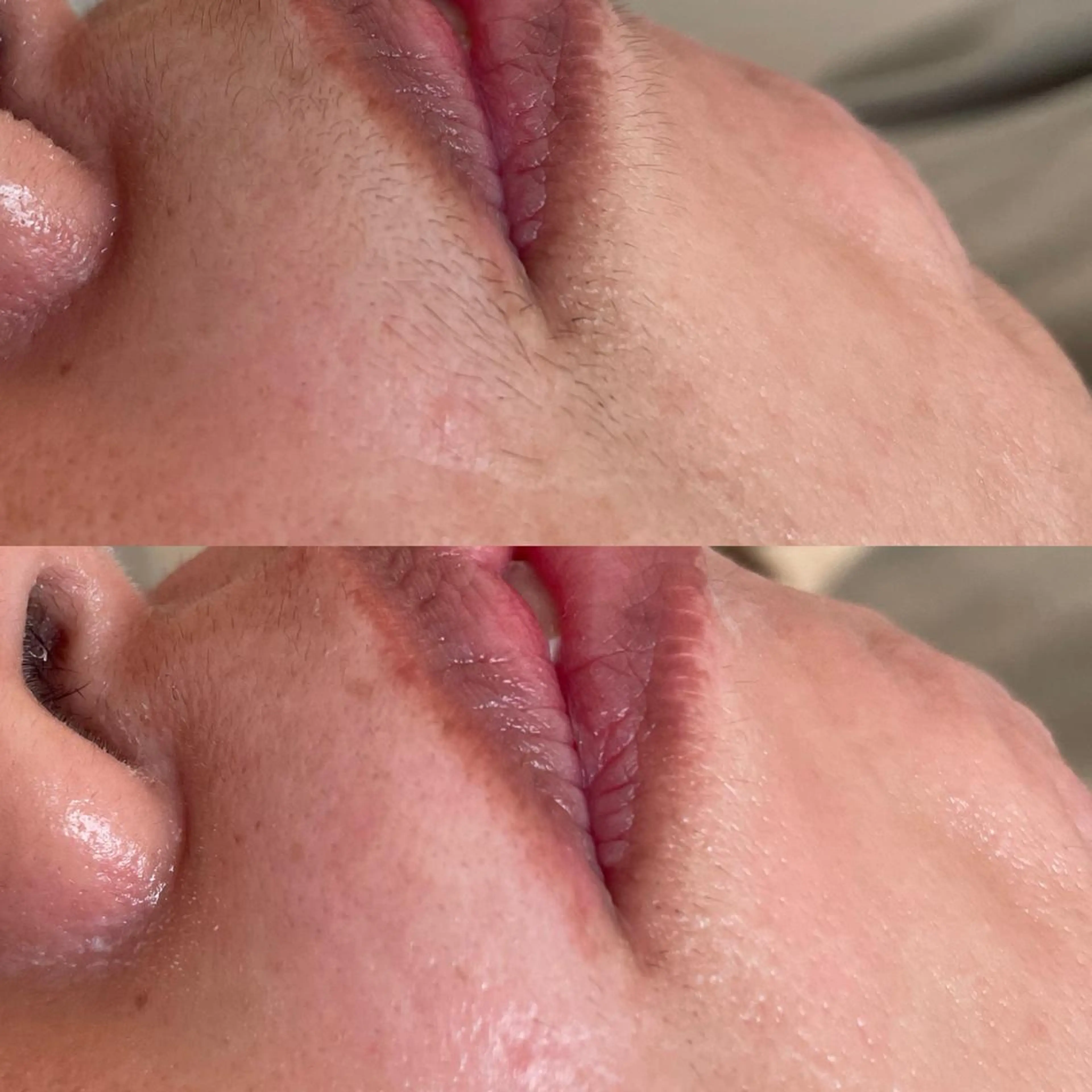 amu nail. RINAのネイルデザイン