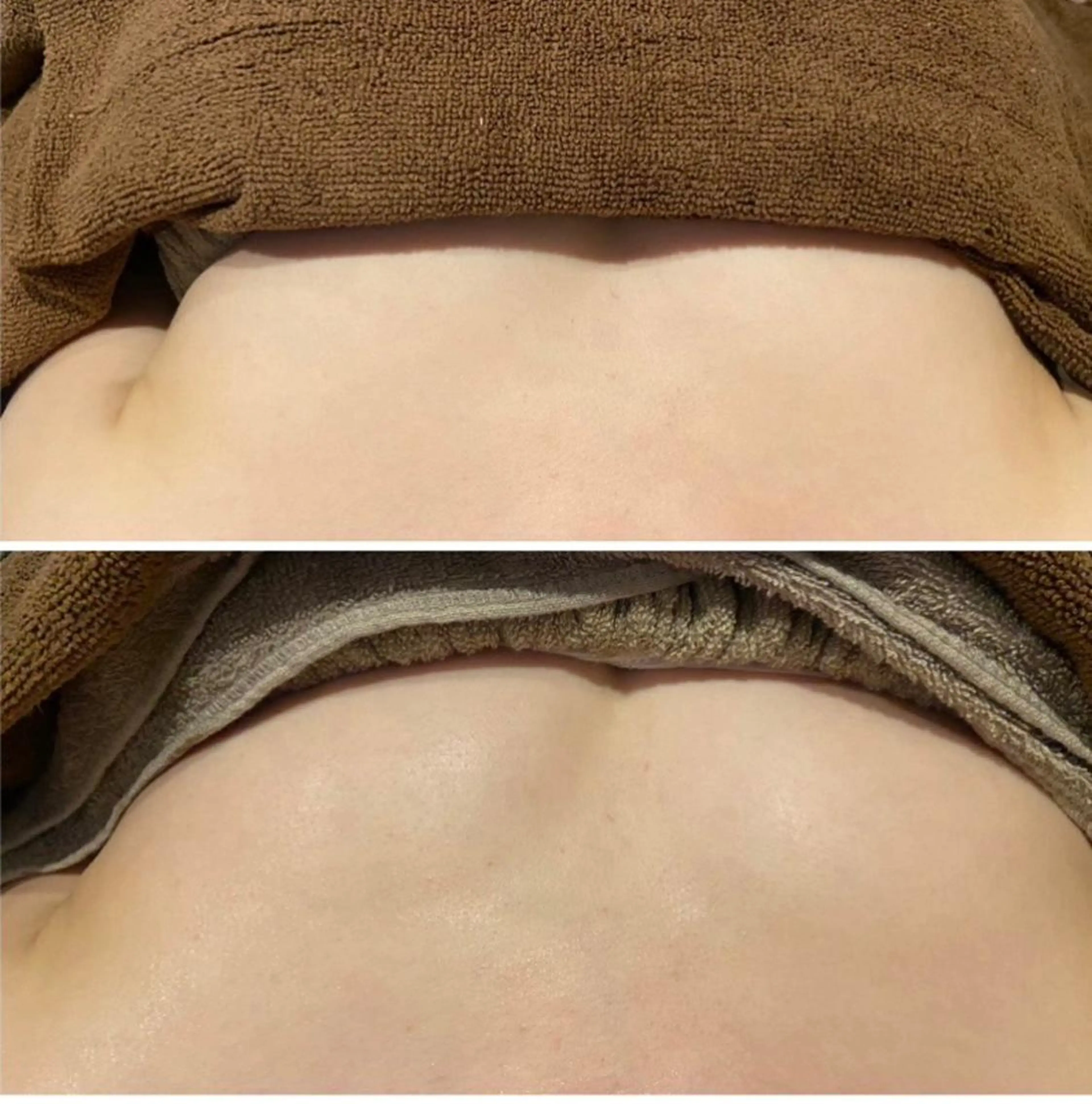 南森町・肌質改善 BELMIMARのエステ・リラクイメージ