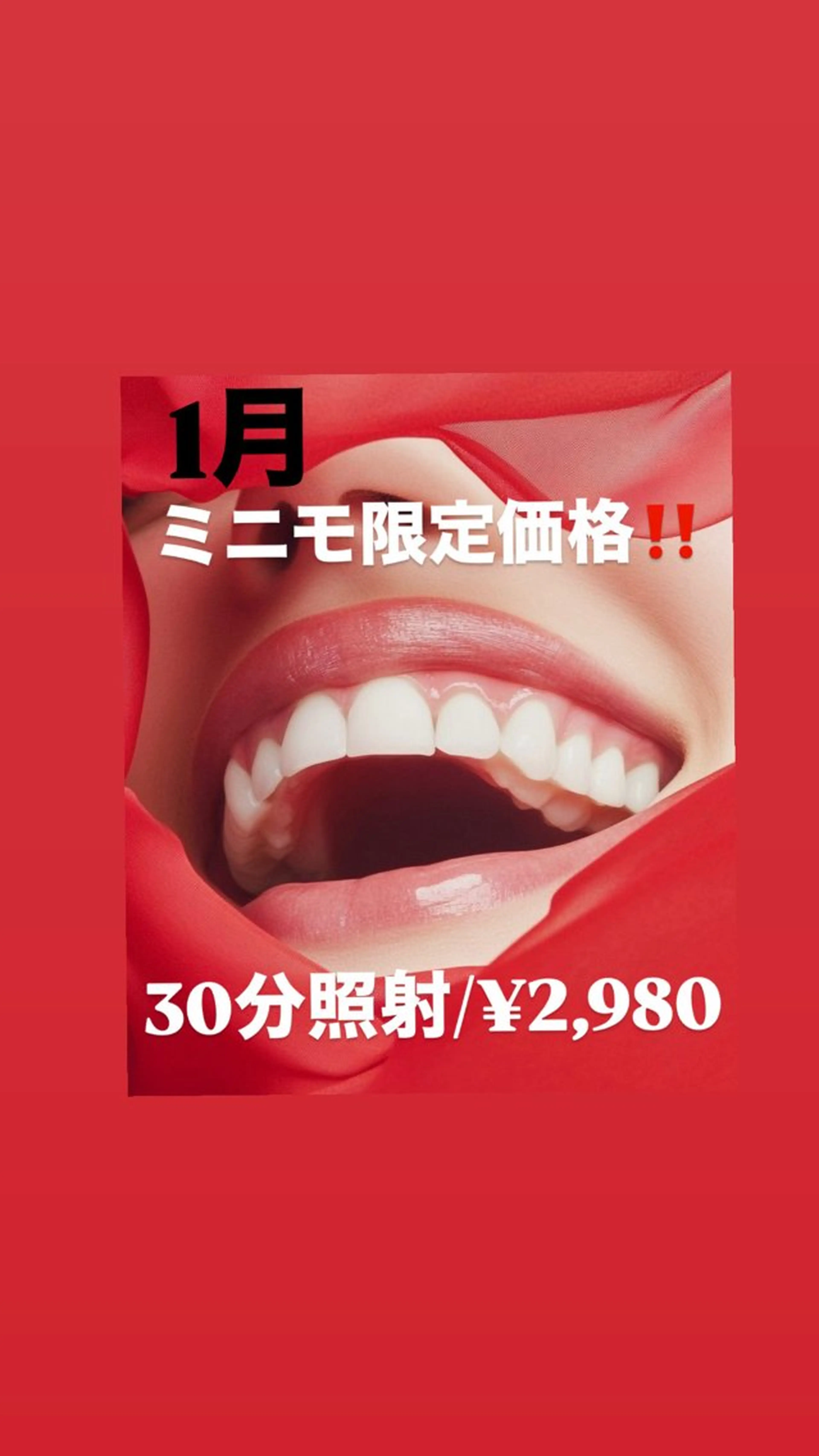 【1月限定🉐♥️】ミニモ割‼️30分照射¥2,980の写真