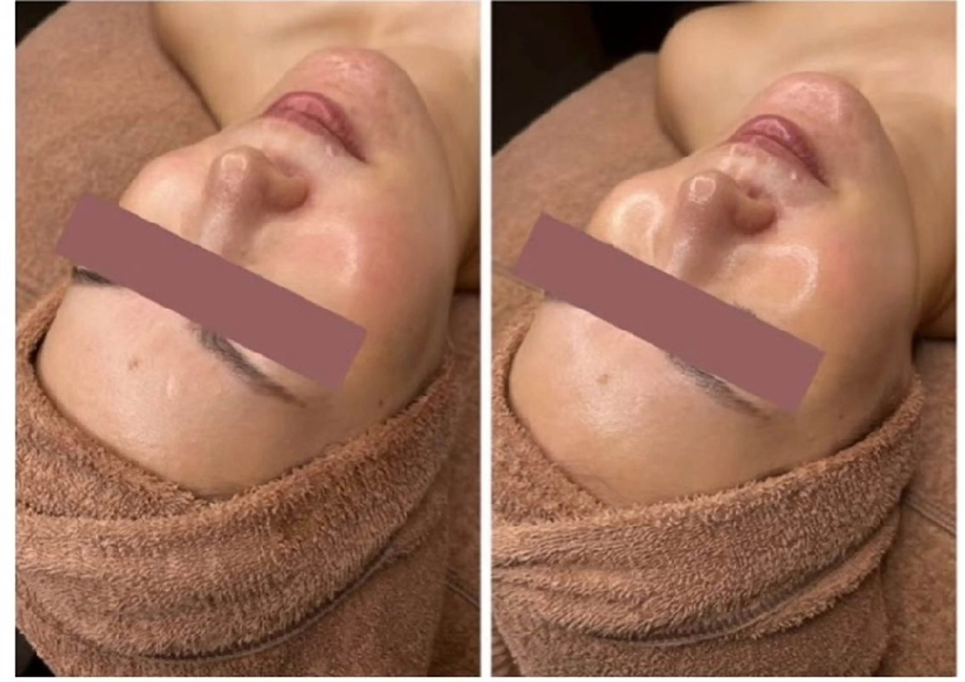 エステ 美u•p 鶴ヶ峰店のマツエク・マツパデザイン