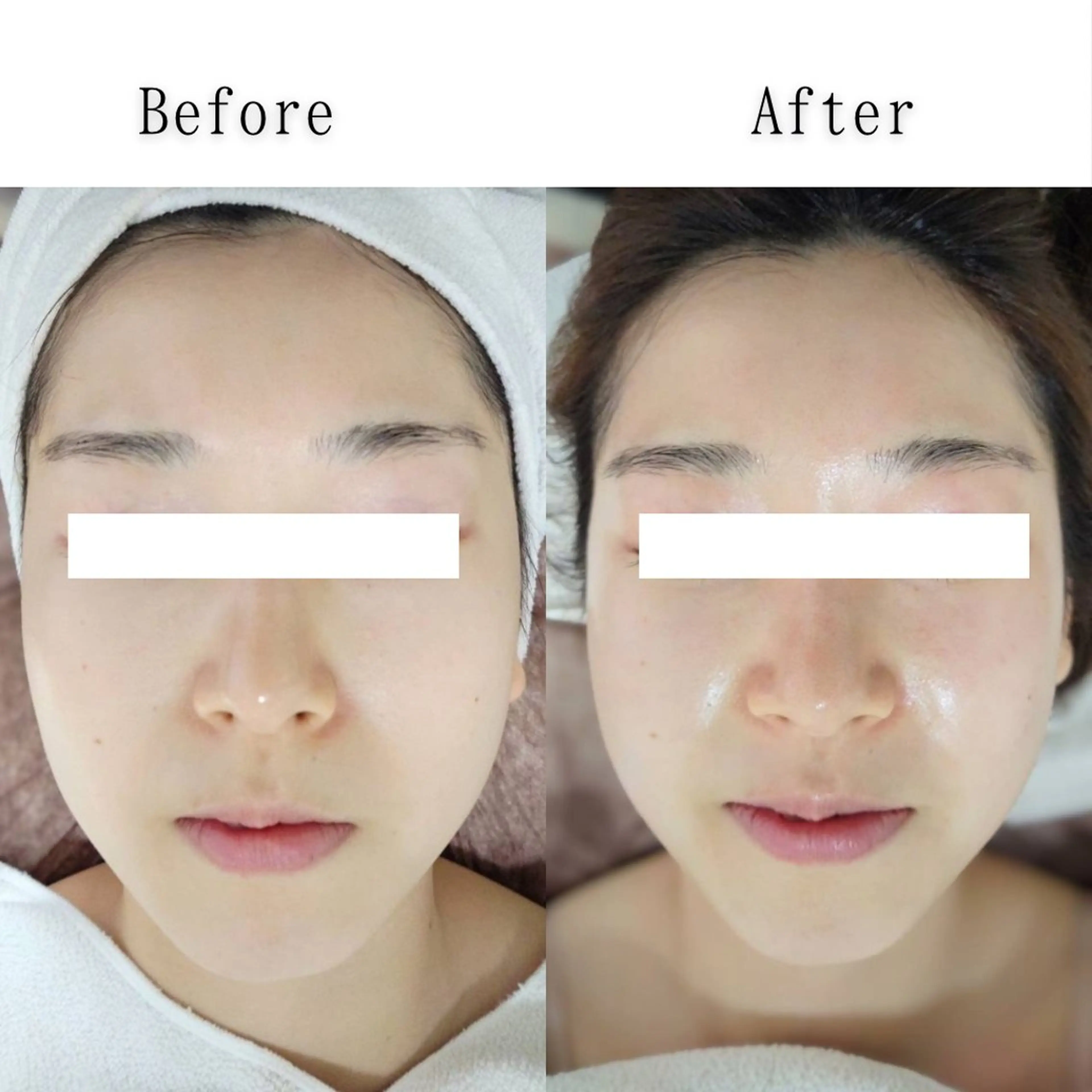 エステ SELF  BEAUTY gracia浦添店所属・gracia 浦添店のその他イメージ