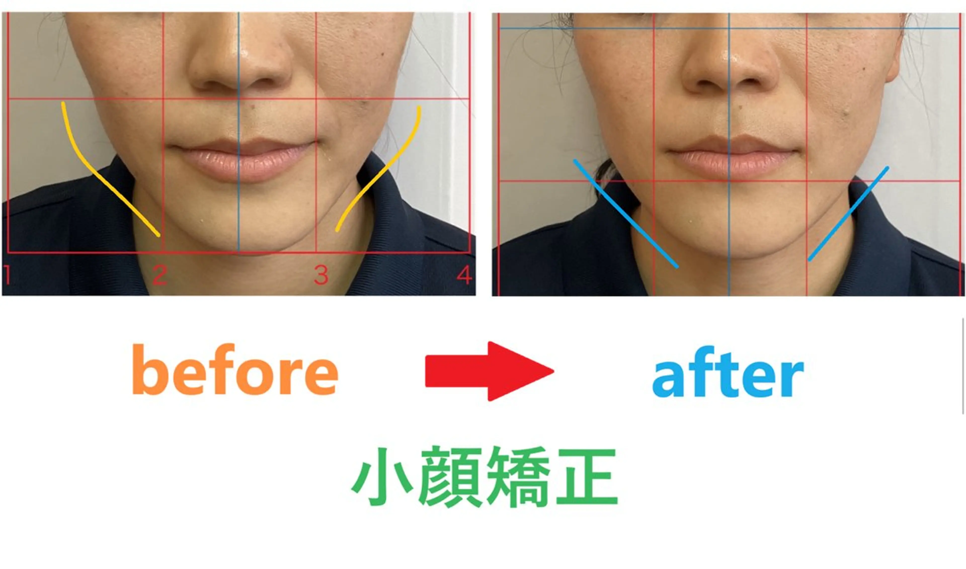 豊津BM整骨院所属・木田 明訓のエステ・リラクイメージ