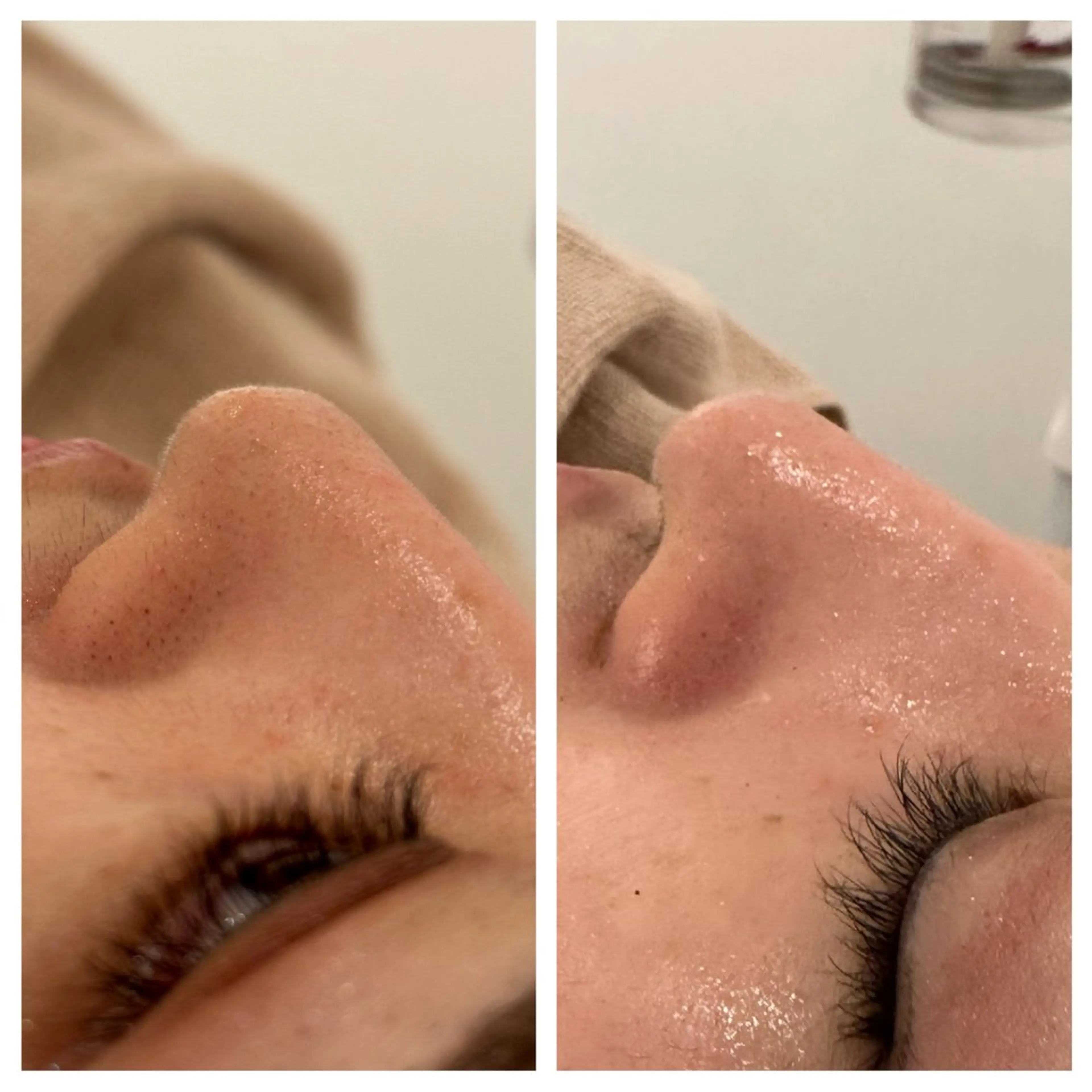 エステ リラク ANERA Second所属・尾上 沙織のエステ・リラクイメージ