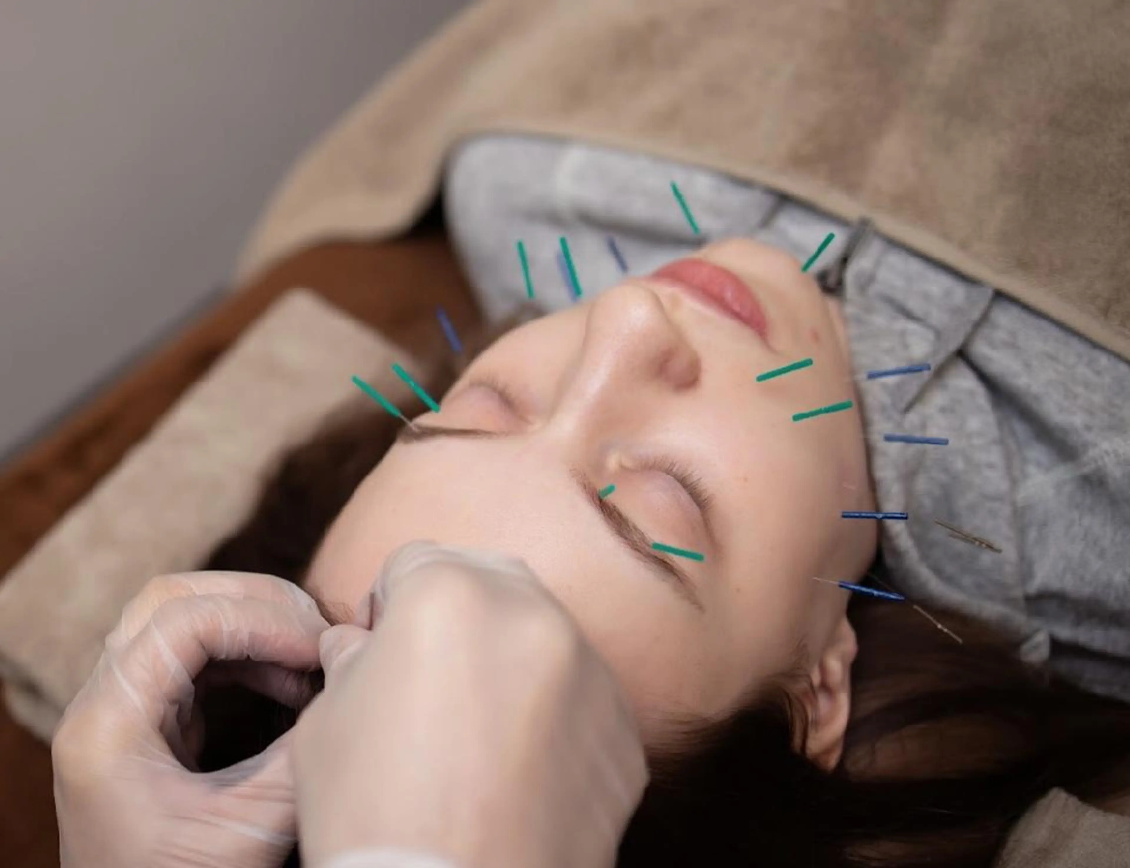 表参道鍼灸院K 美容鍼🔮ララピールのエステ・リラクイメージ