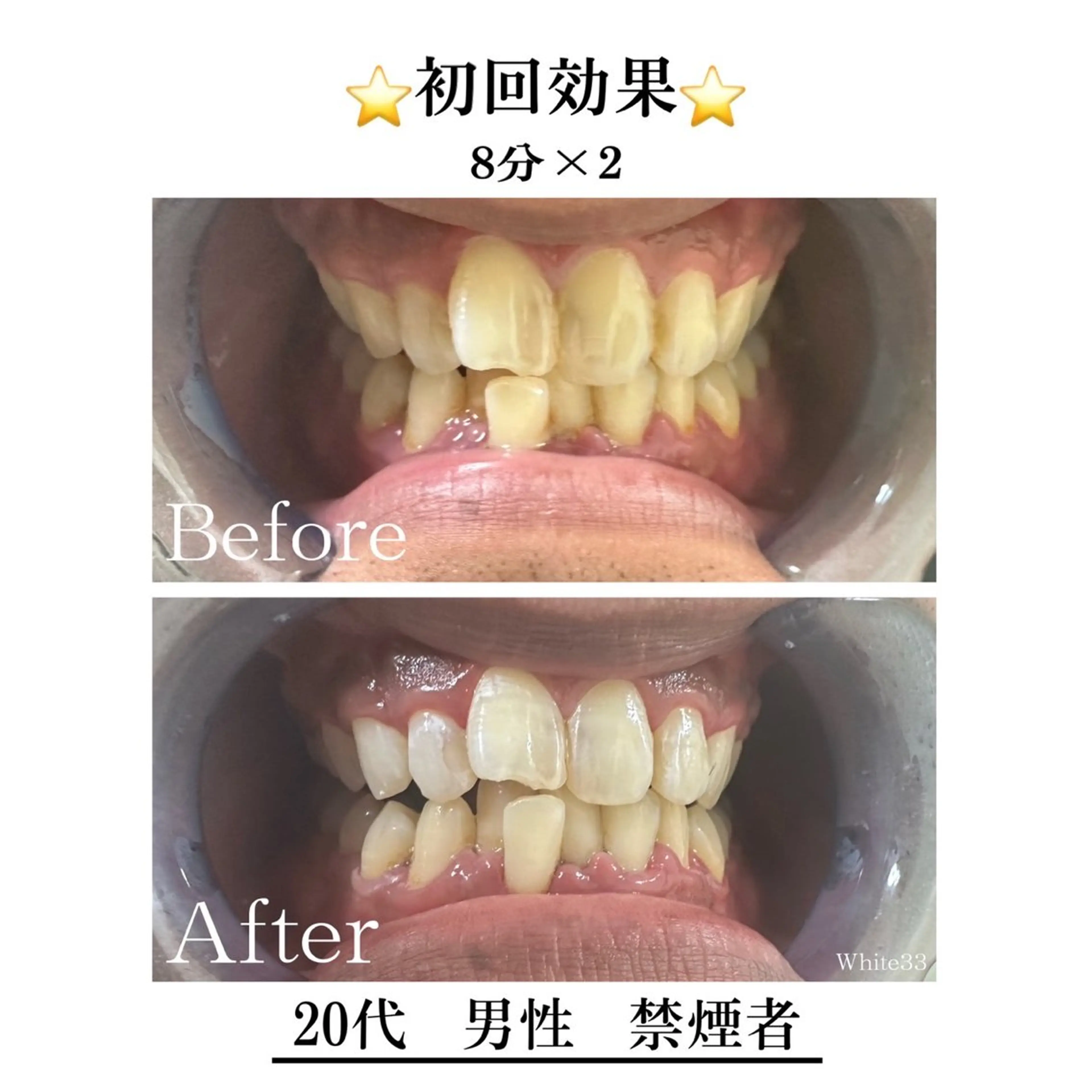 セルフホワイトニング White33大名のその他イメージ