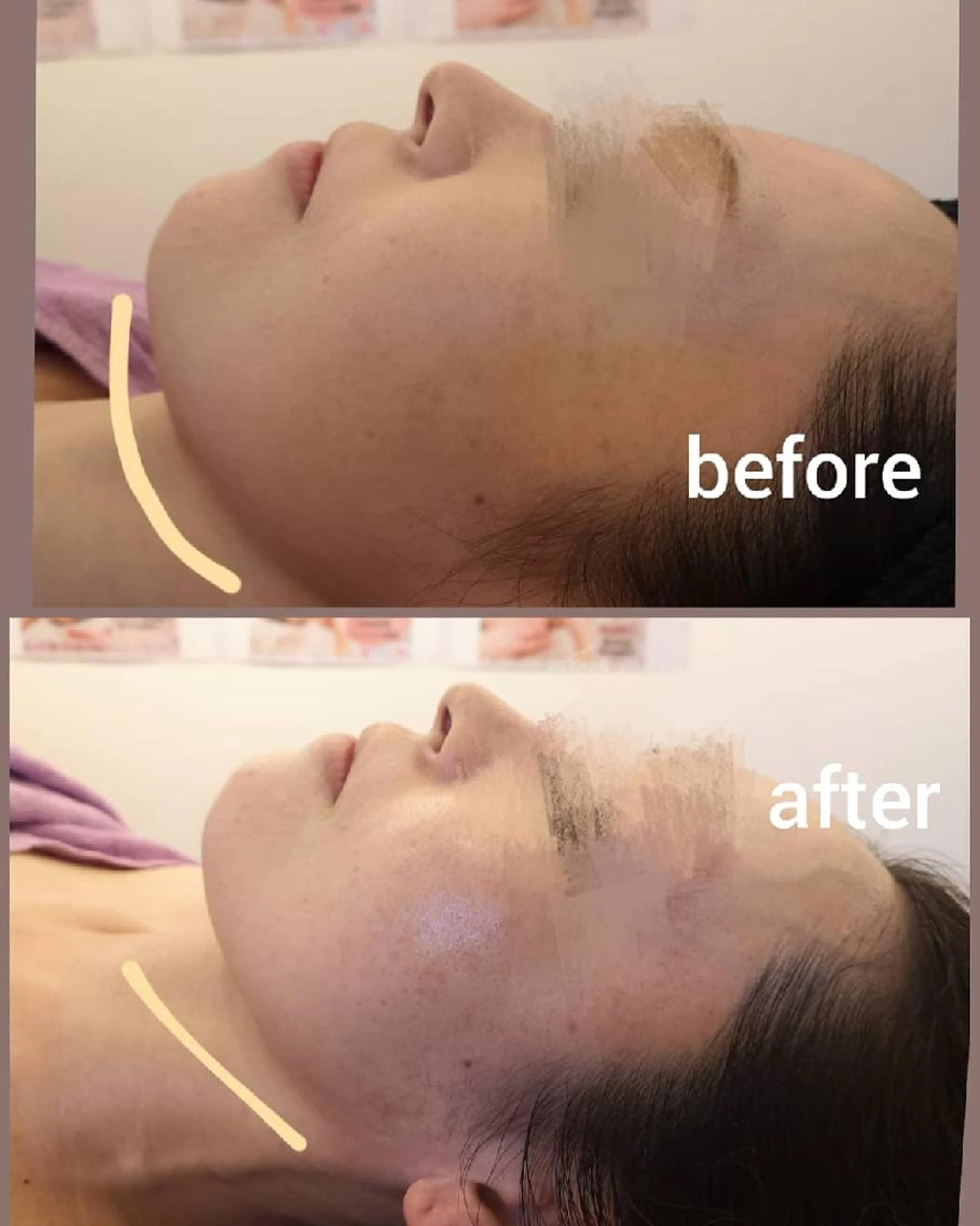 オススメ🫶不純物なしタラソトリートメント！肌荒れ原因、乾燥、ニキビケア、エイジングケア、美白に🙆の写真