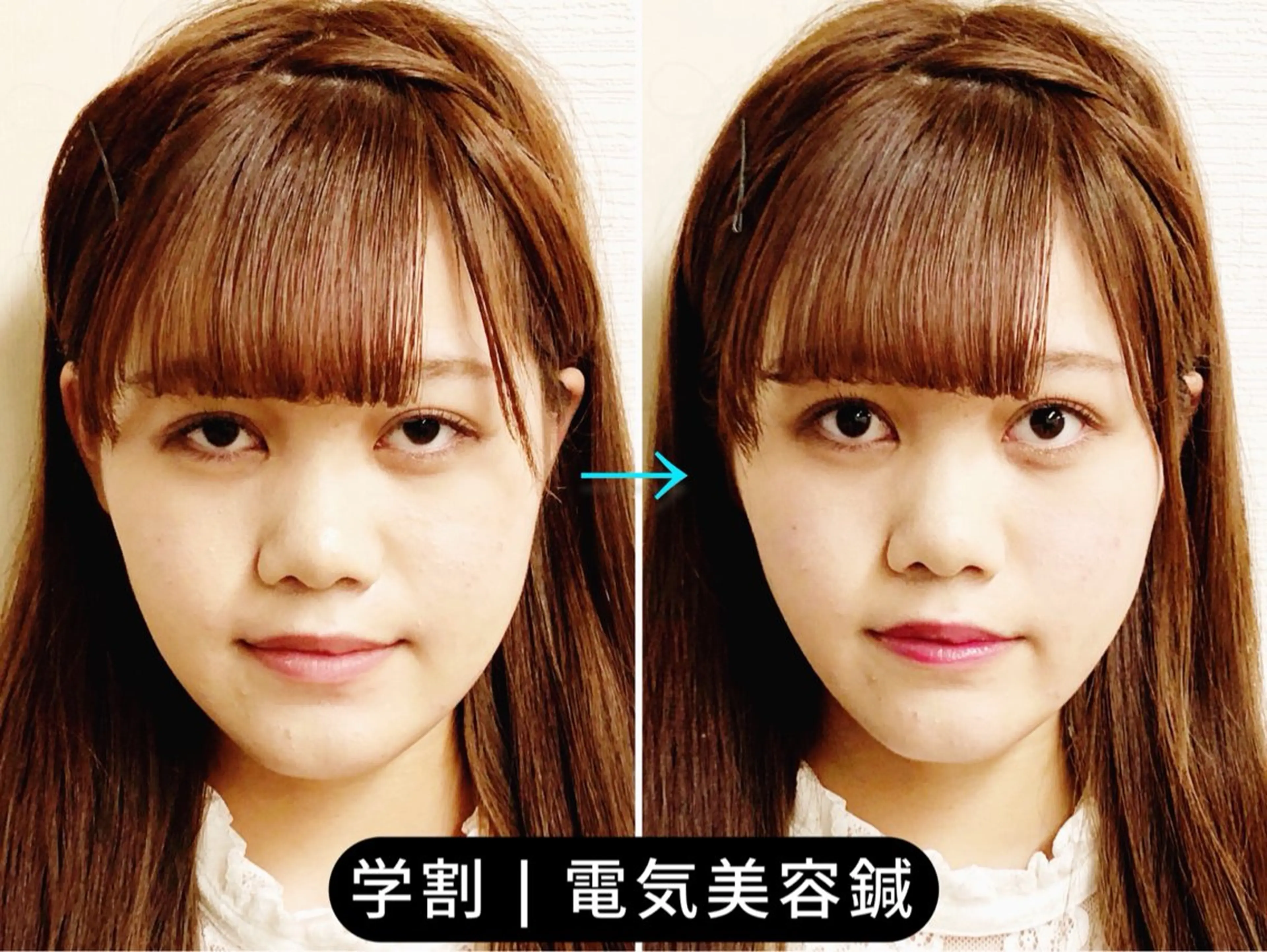 エステ リラク 小顔美容鍼専門サロン 渋谷YZのエステ・リラクイメージ