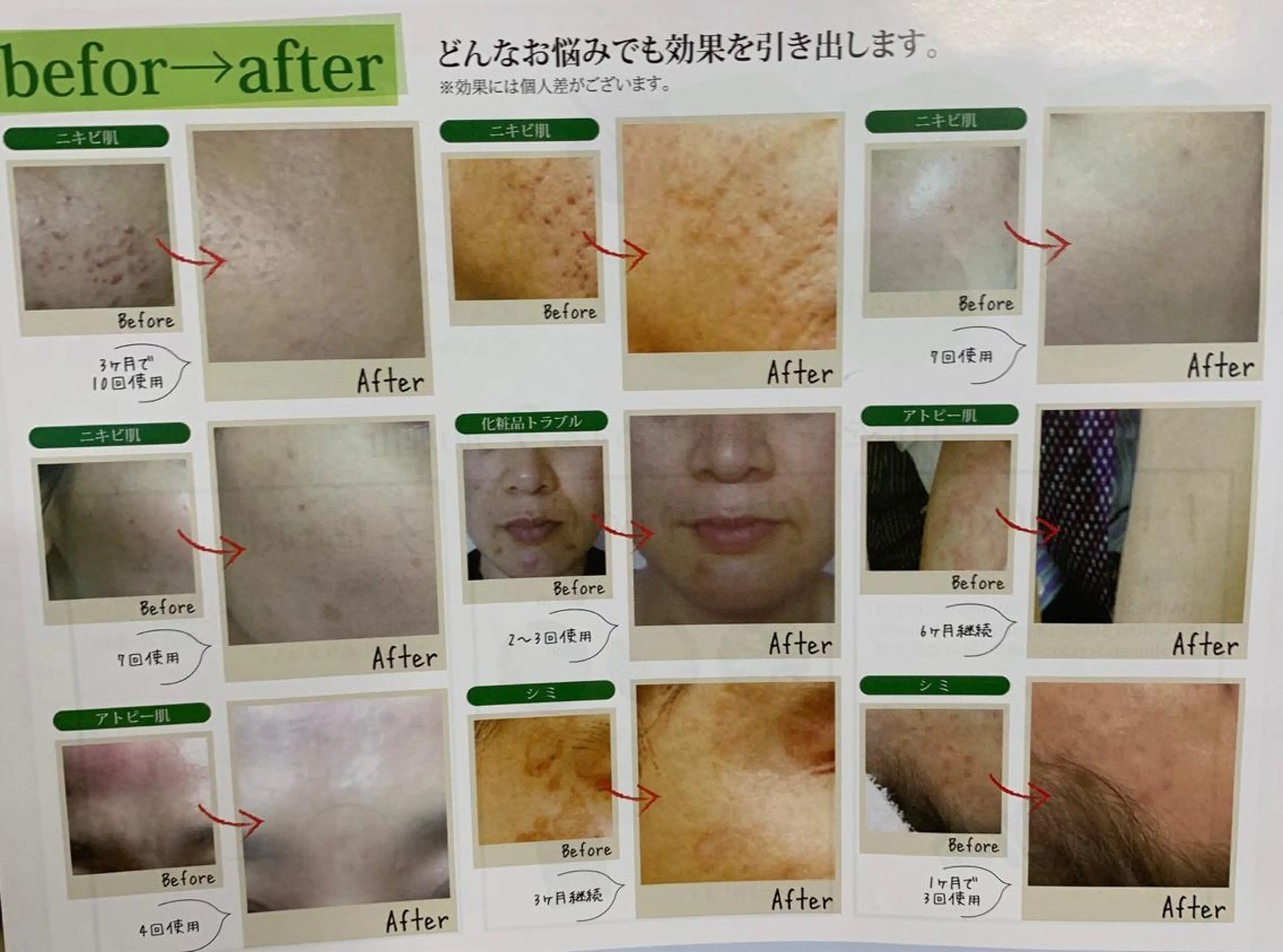 217whitening  room所属・217 ホワイトニングルームのエステ・リラクイメージ