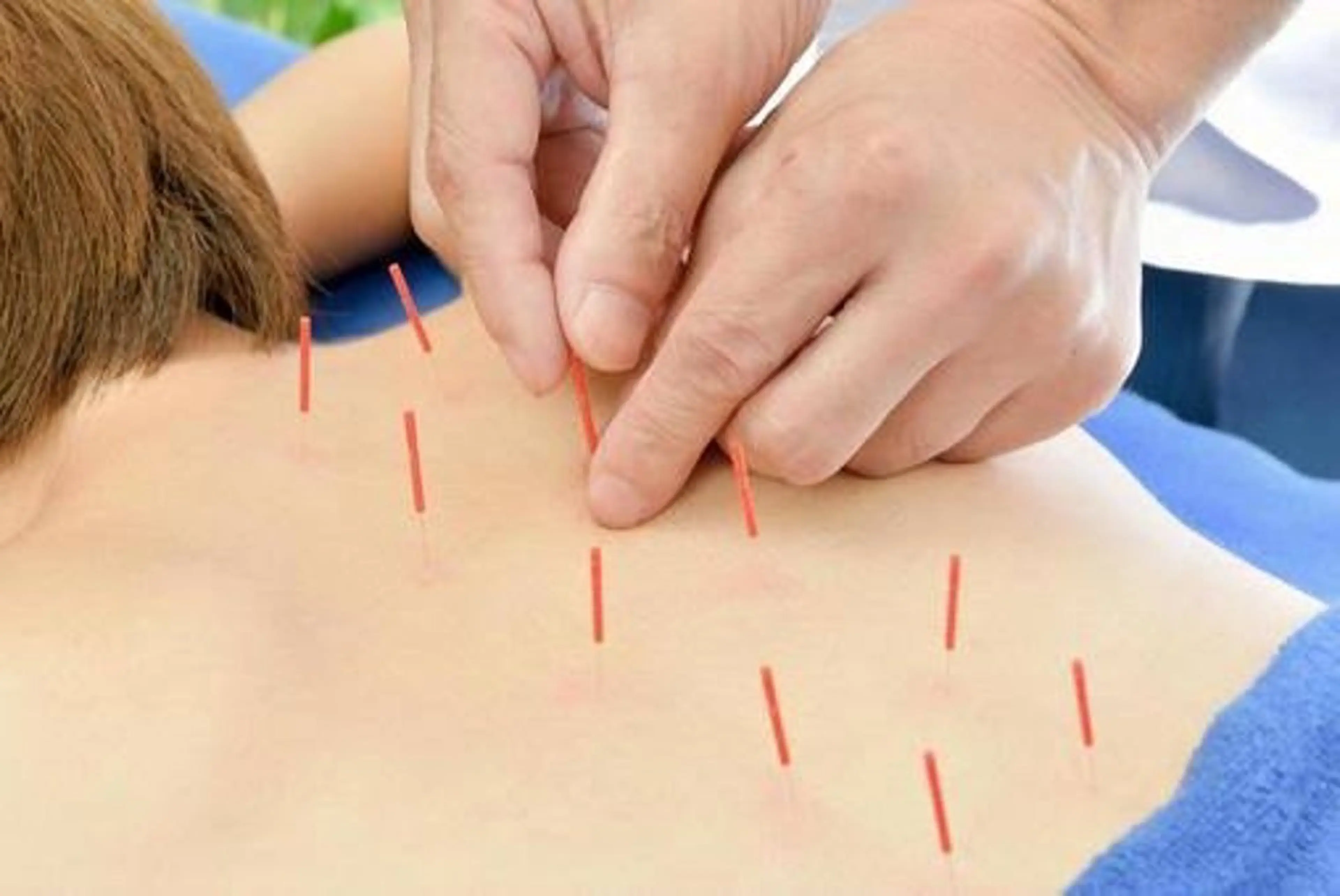 【minimo限定価格🎵】✨整体&鍼施術✨の写真