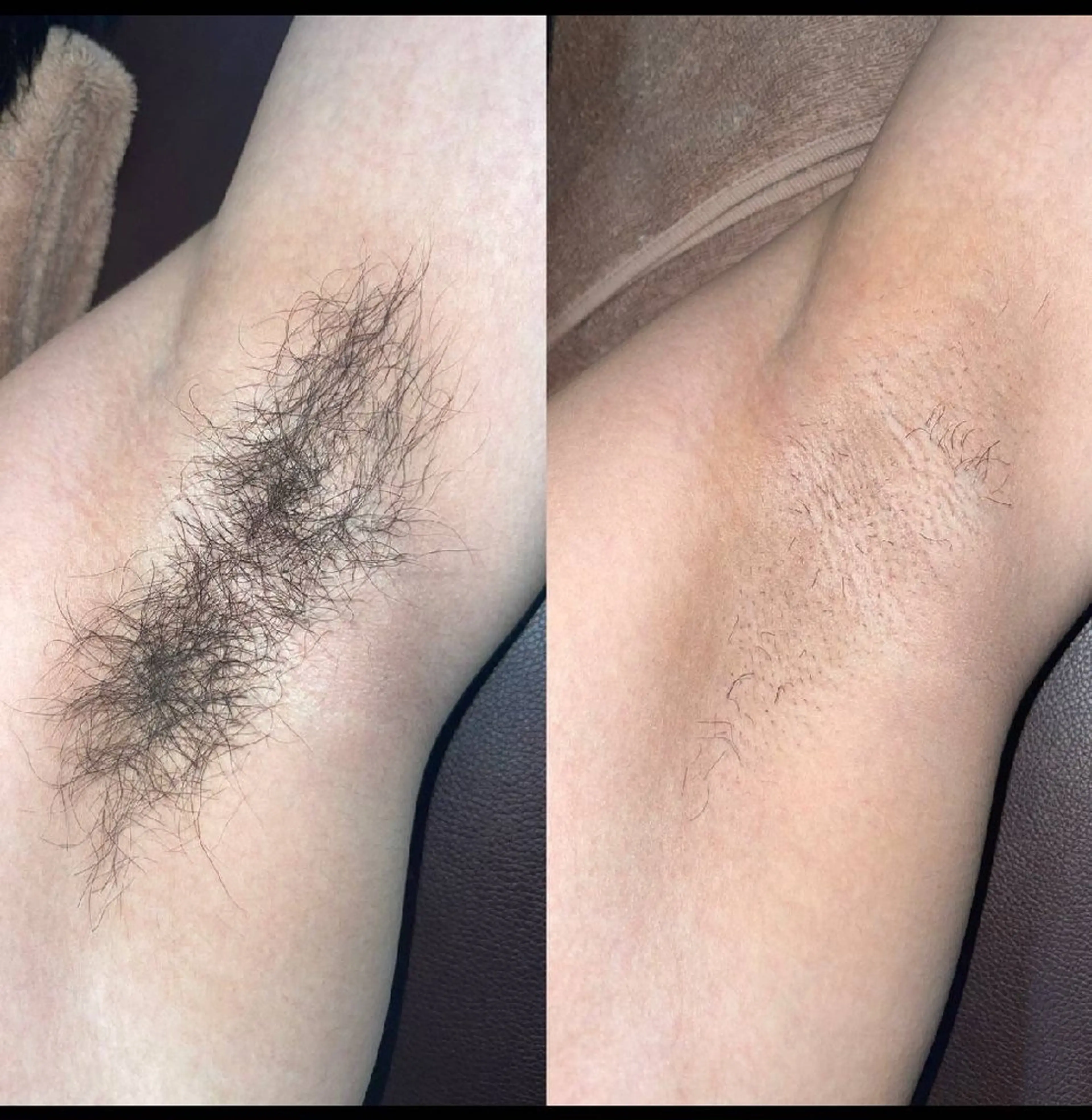 LOUISE.／脱毛所属・LOUISE. ／脱毛のエステ・リラクイメージ