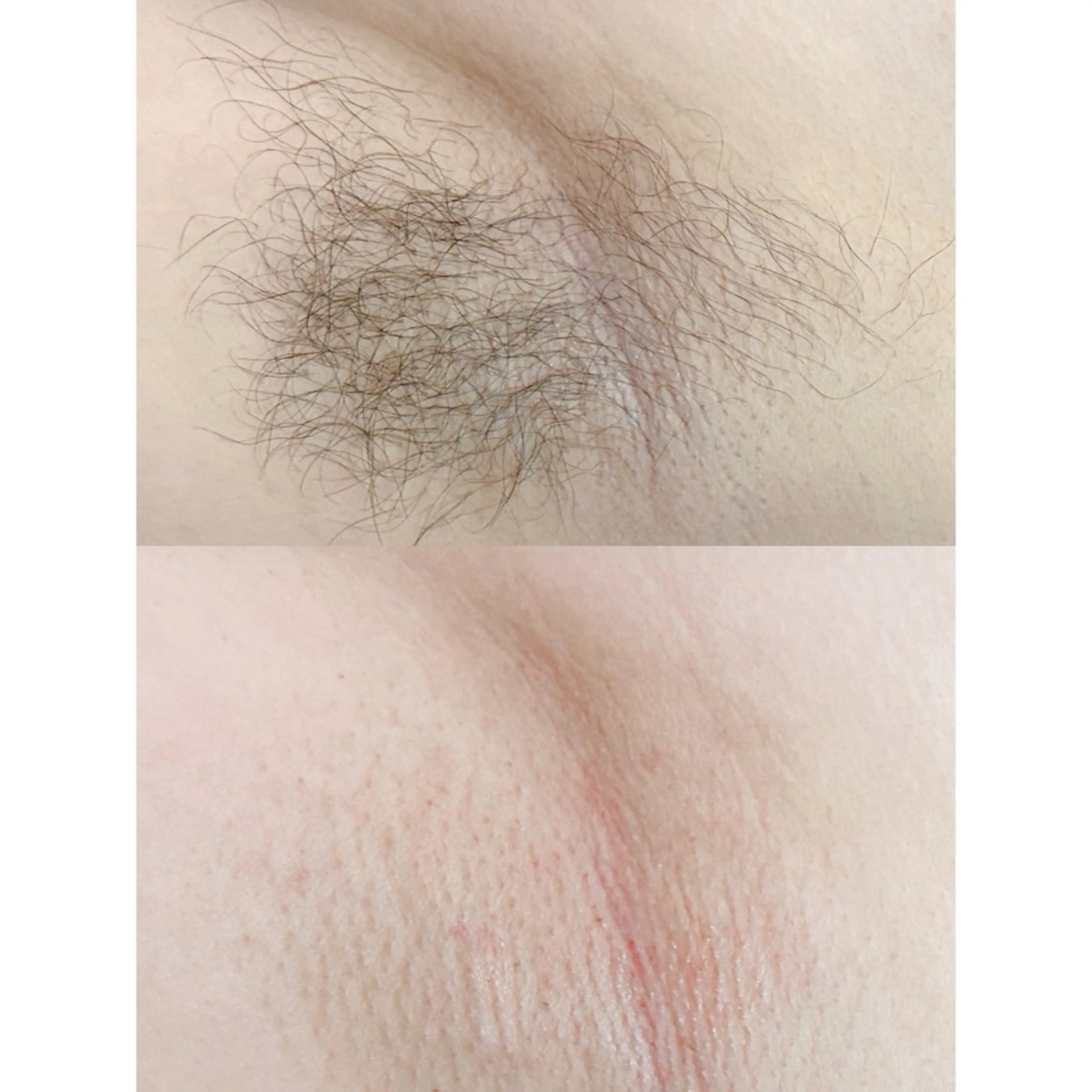 Hit. シュガーリング豊橋のエステ・リラクイメージ