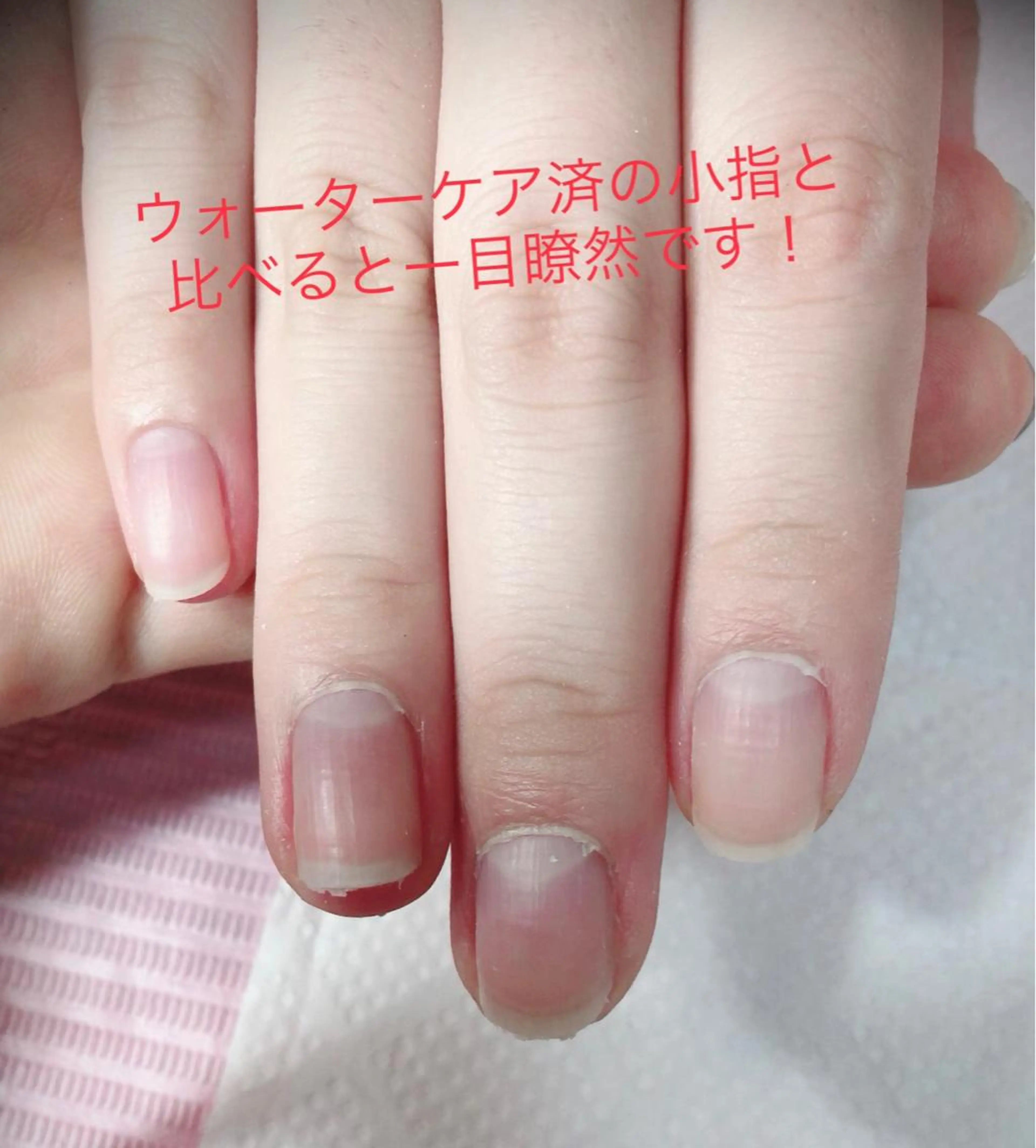 ネイル 北浦和 自爪育成ケアのネイルデザイン