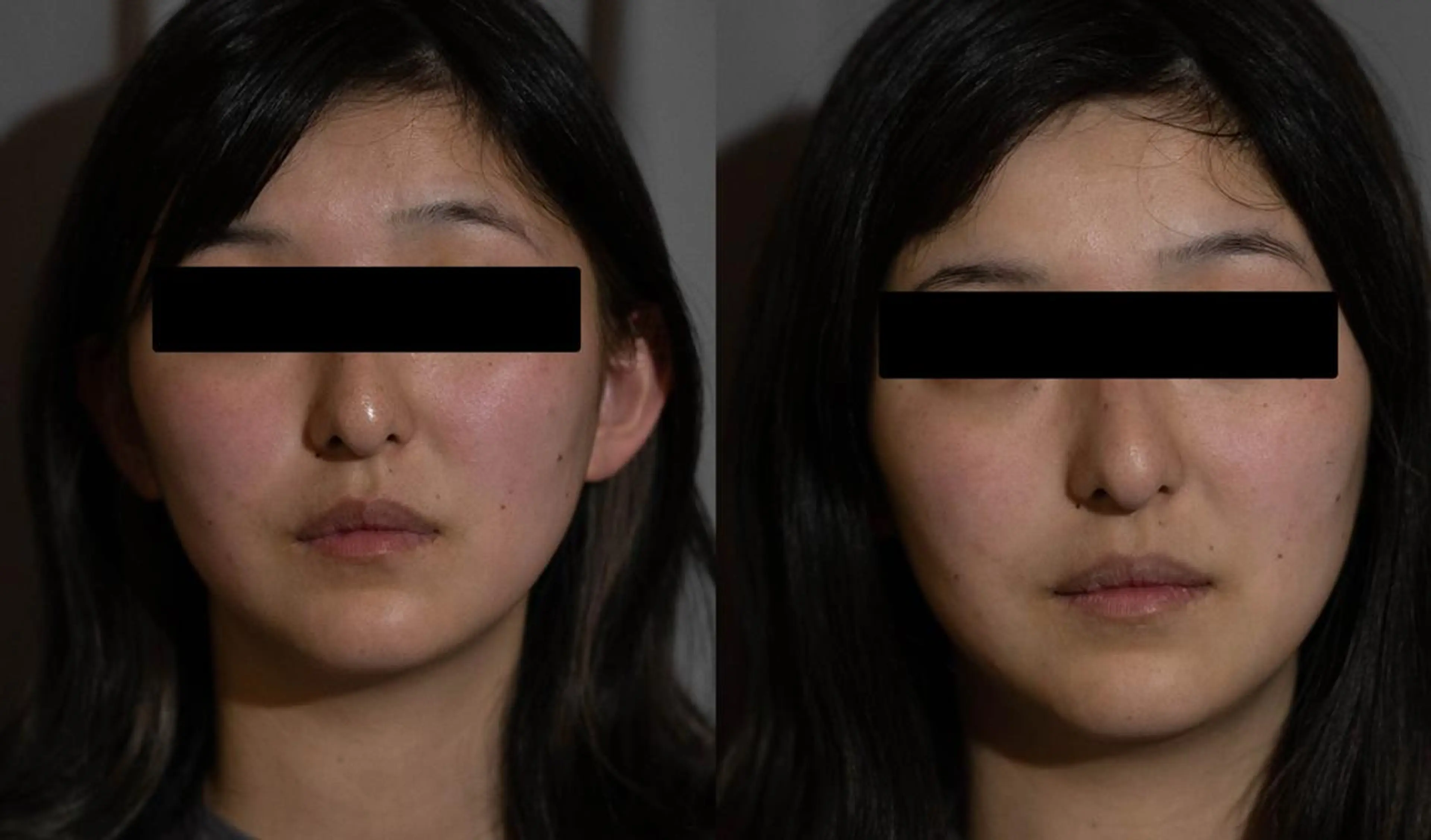 中山 秀展のエステ・リラクイメージ