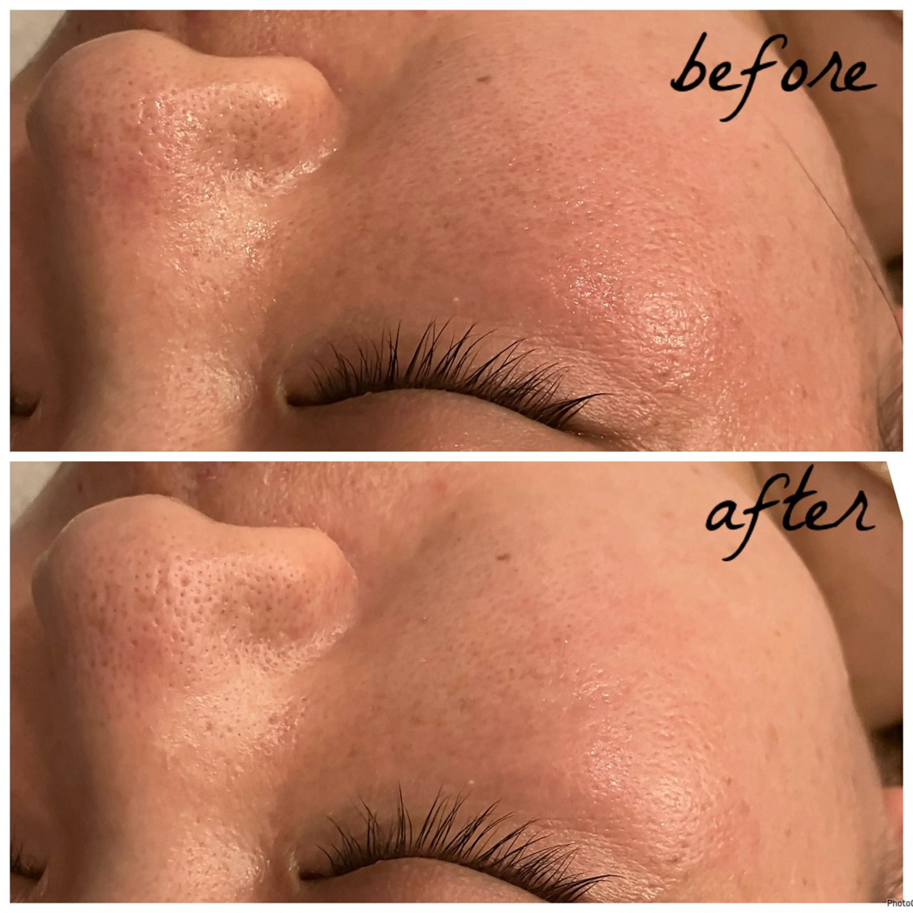 メンズ エステ メナード岐阜茜部 杉浦のエステ・リラクイメージ