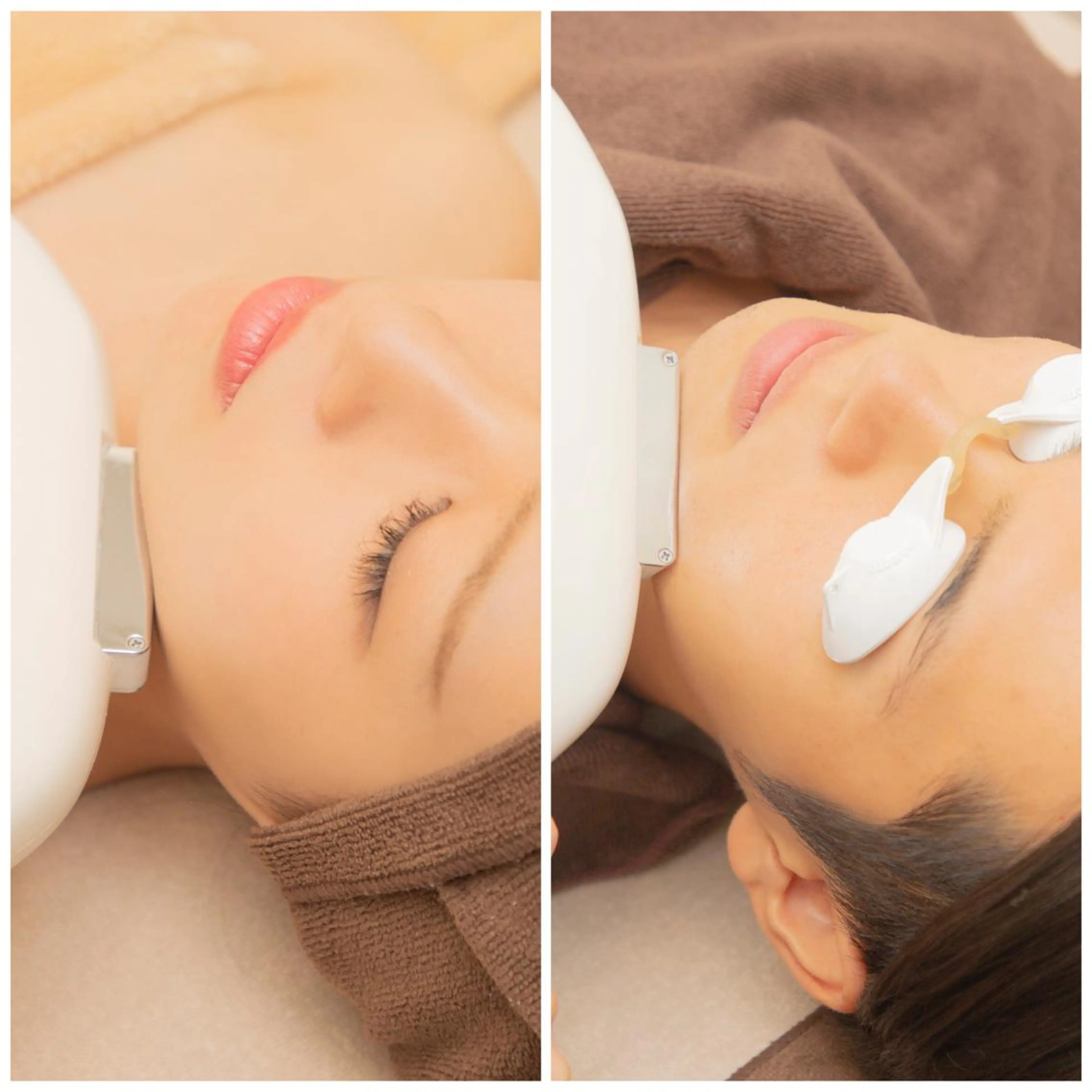 レディース・メンズ■IPL光フェイシャル■美肌/ハリ/シミシワ/毛穴/肌質改善■5500円の写真