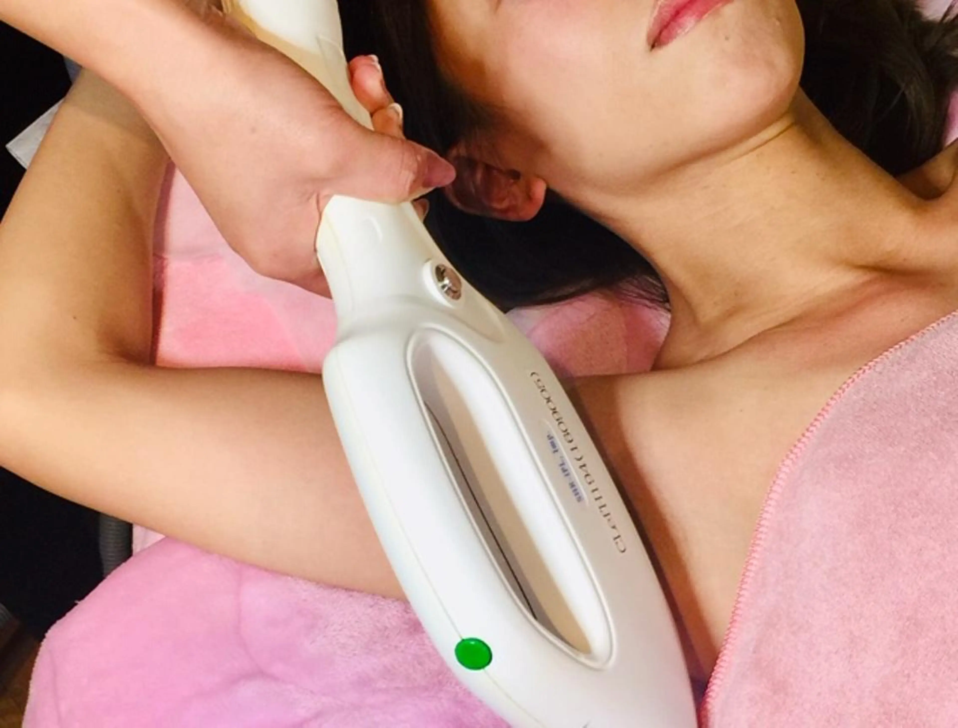 【わき＆あし全体脱毛 6点】 わき× あし全体×甲,指の写真