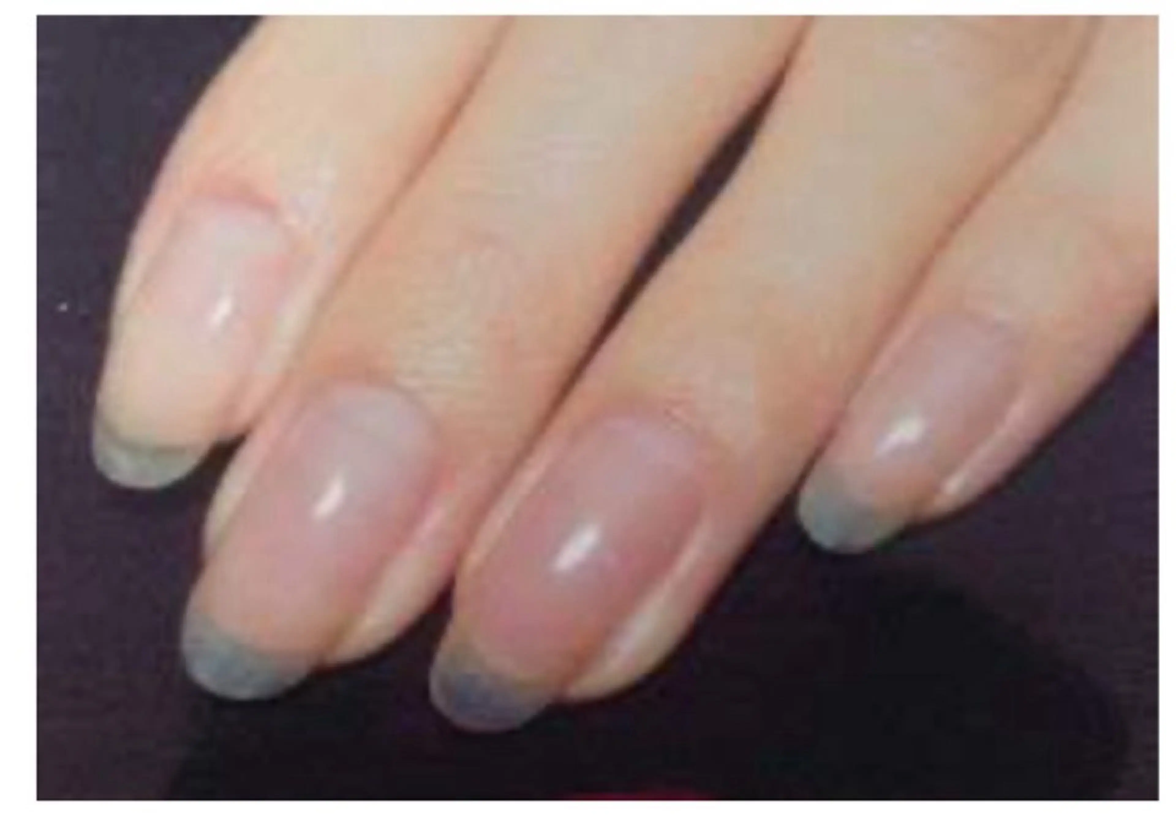 ネイル フラッシュネイル Nail&EyeLash Vinaゆめタウン呉店所属・VinaNail sakuraのネイルデザイン