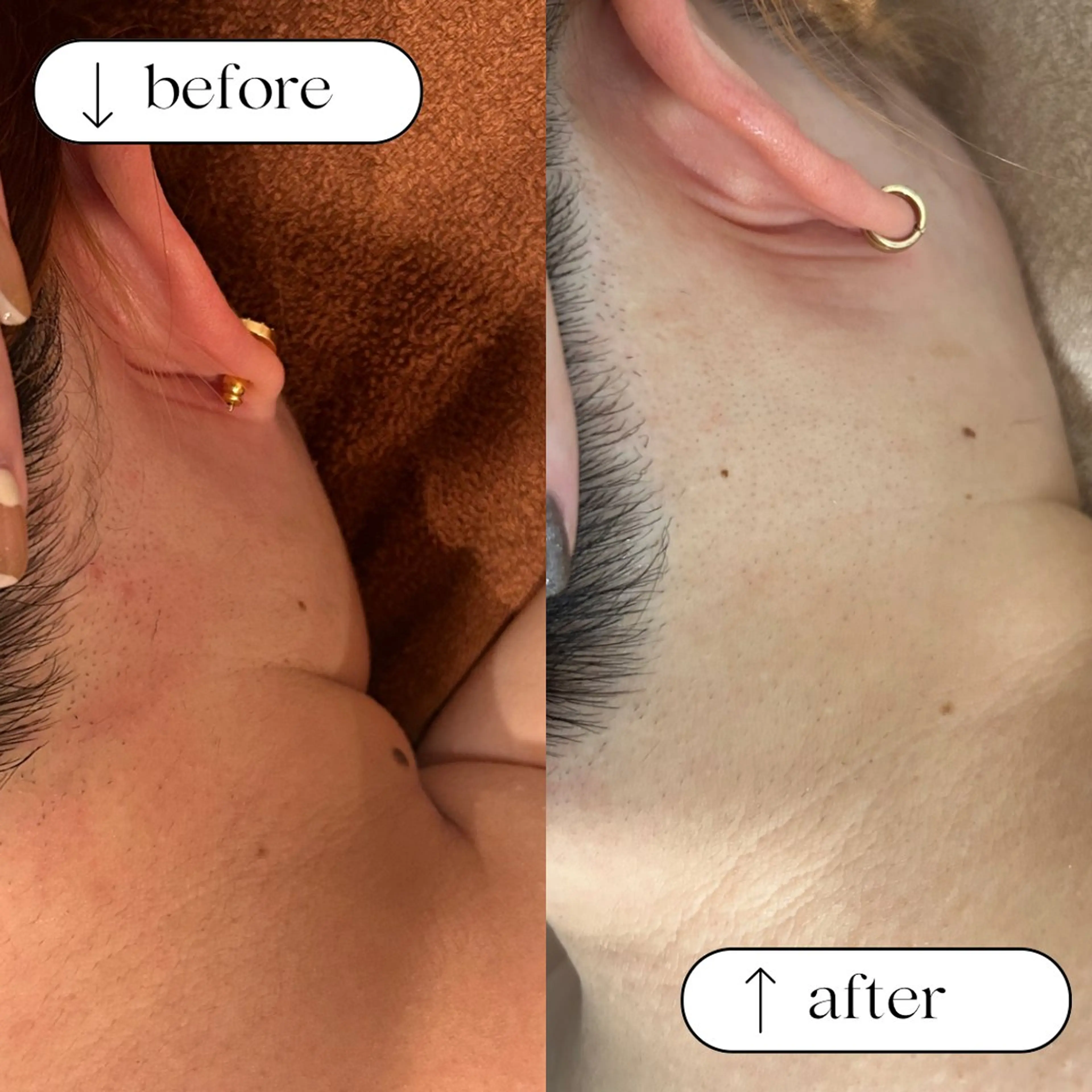 メンズ 脱毛・フェイシャルエステ専門サロン　NUXS SAKAE所属・NUXS SAKAEのエステ・リラクイメージ