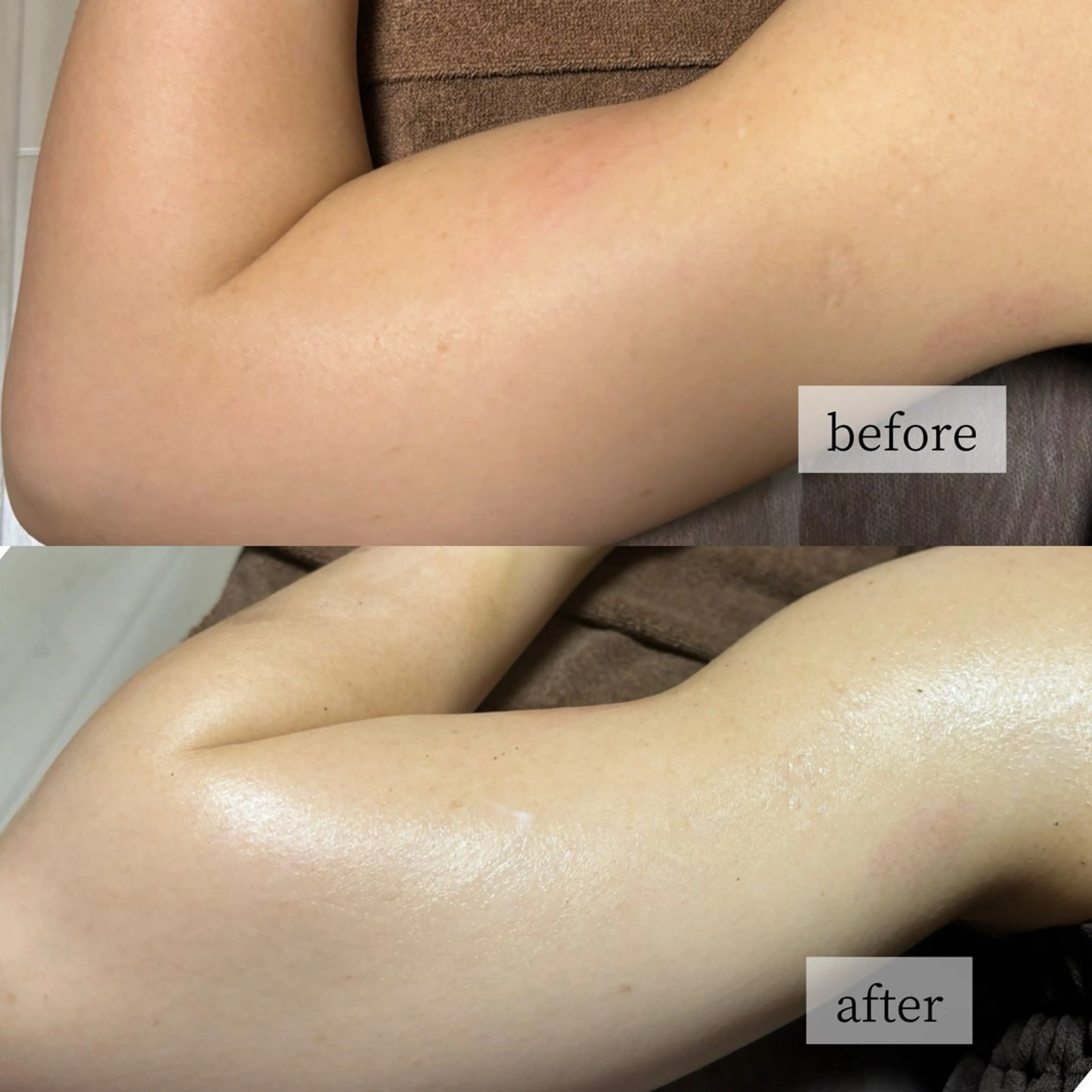 HINANO矢場町店【ヒナノ】所属・脱毛/肌改善🌿 HINANO 村田のエステ・リラクイメージ