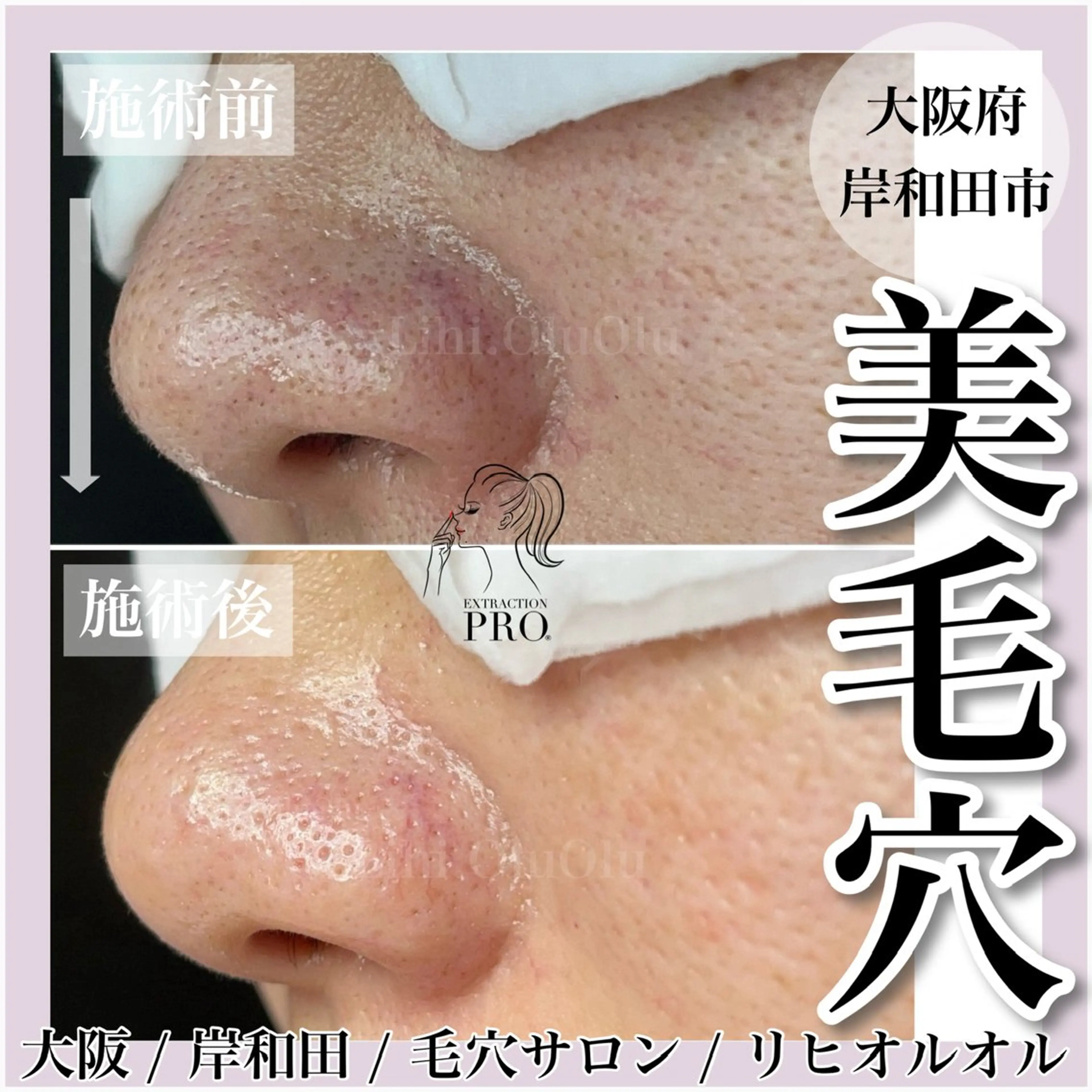 エステ 毛穴汚れ改善専門店/ 岸和田/リヒオルオルのエステ・リラクイメージ