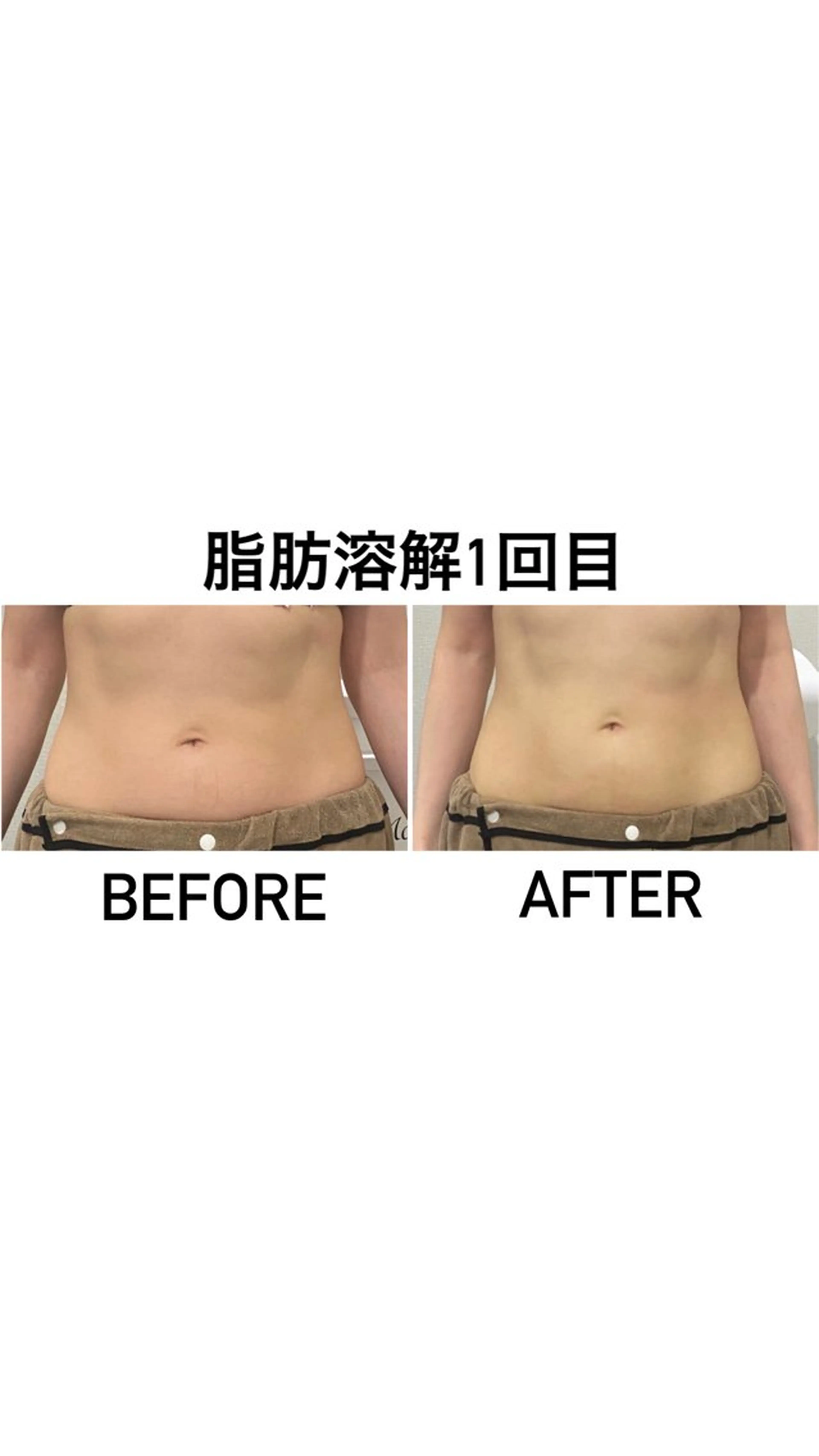 エステ アルカンジュ~archange~所属・痩身/毛穴洗浄/脱毛 アルカンジュのエステ・リラクイメージ