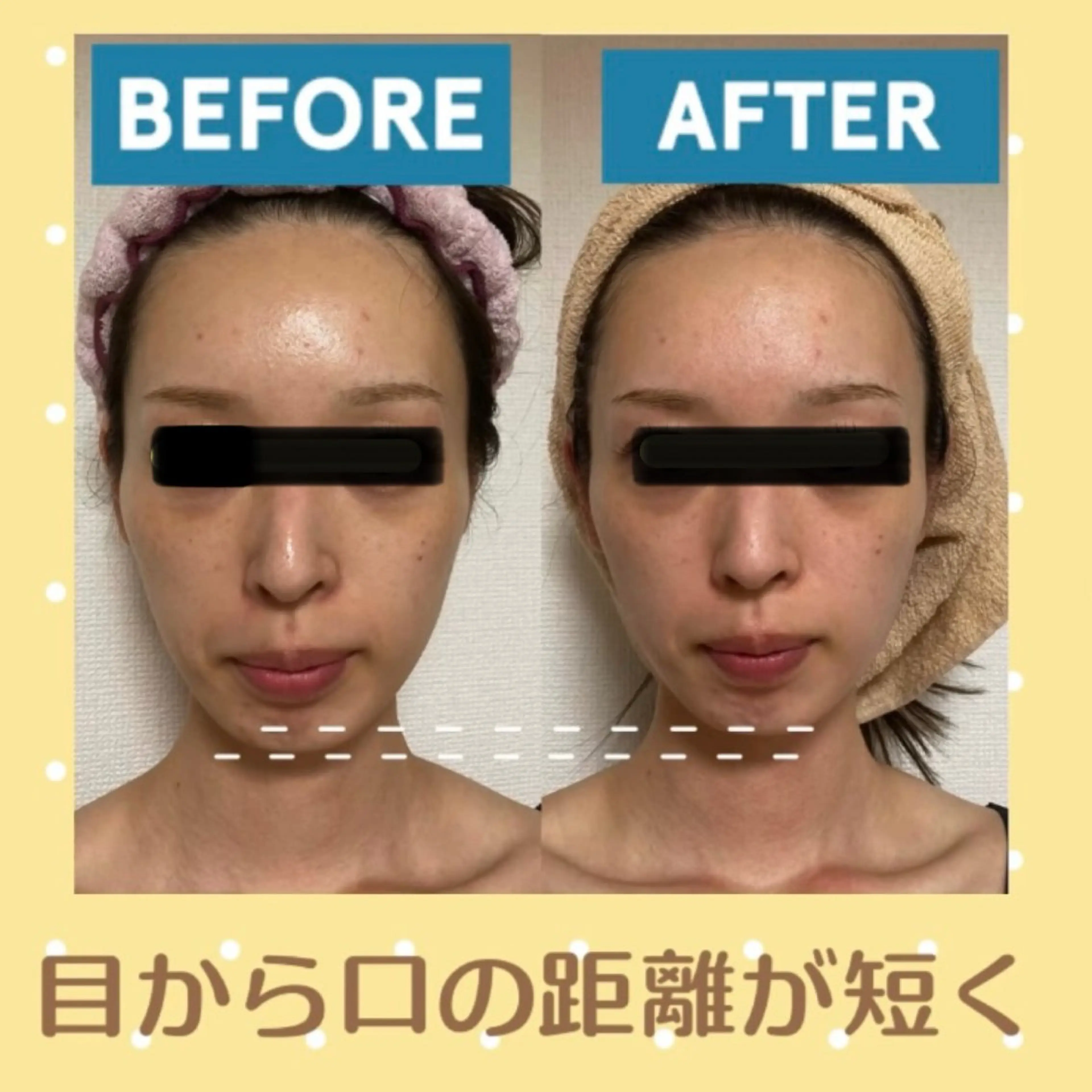 小顔矯正サロン プルメリアのエステ・リラクイメージ