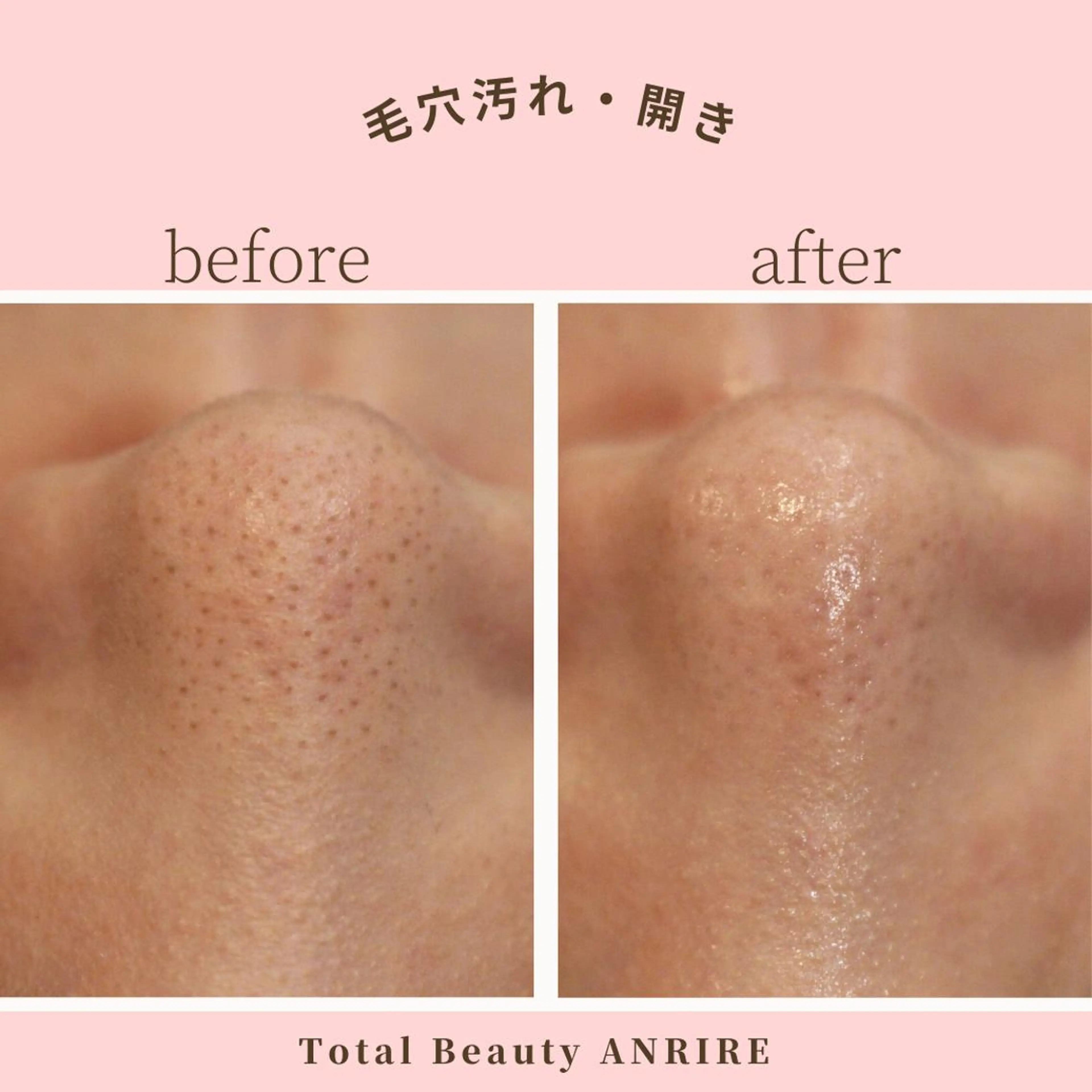 ANRIRE (アンリール)のエステ・リラクイメージ