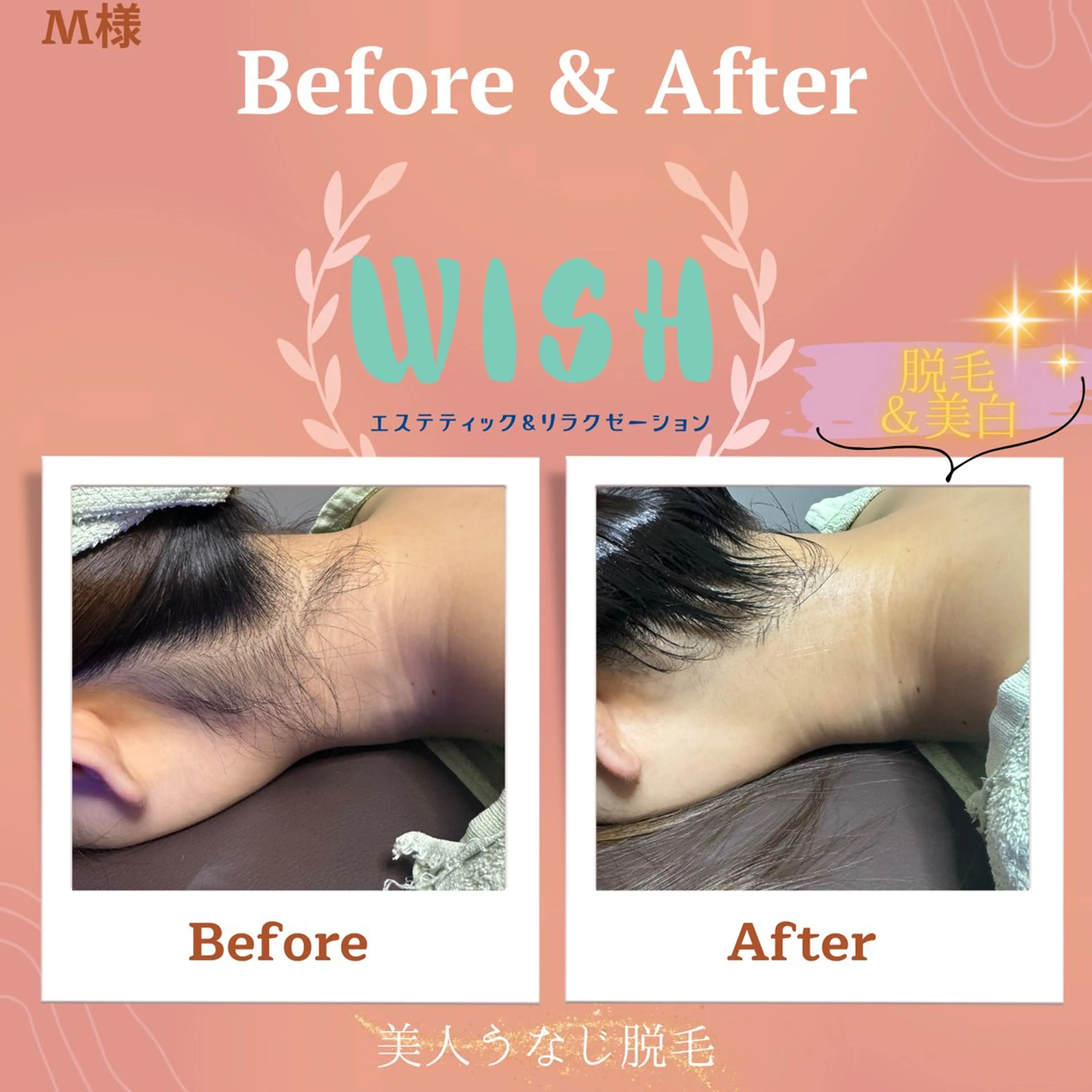 WISH 美肌脱毛のプロ！須藤のエステ・リラクイメージ