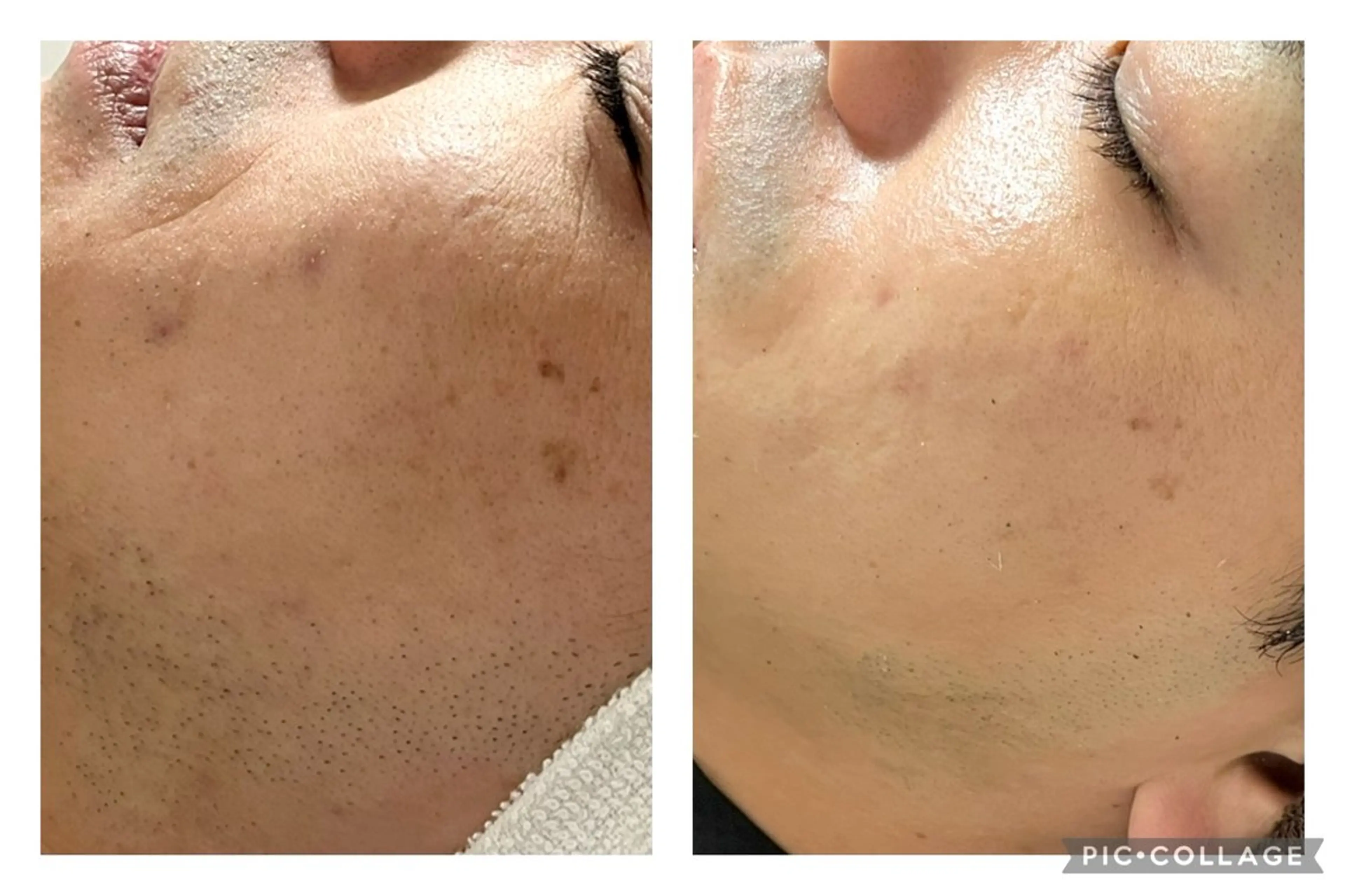 B.glossy所属・ビューティーサロン B.glossyのネイルデザイン