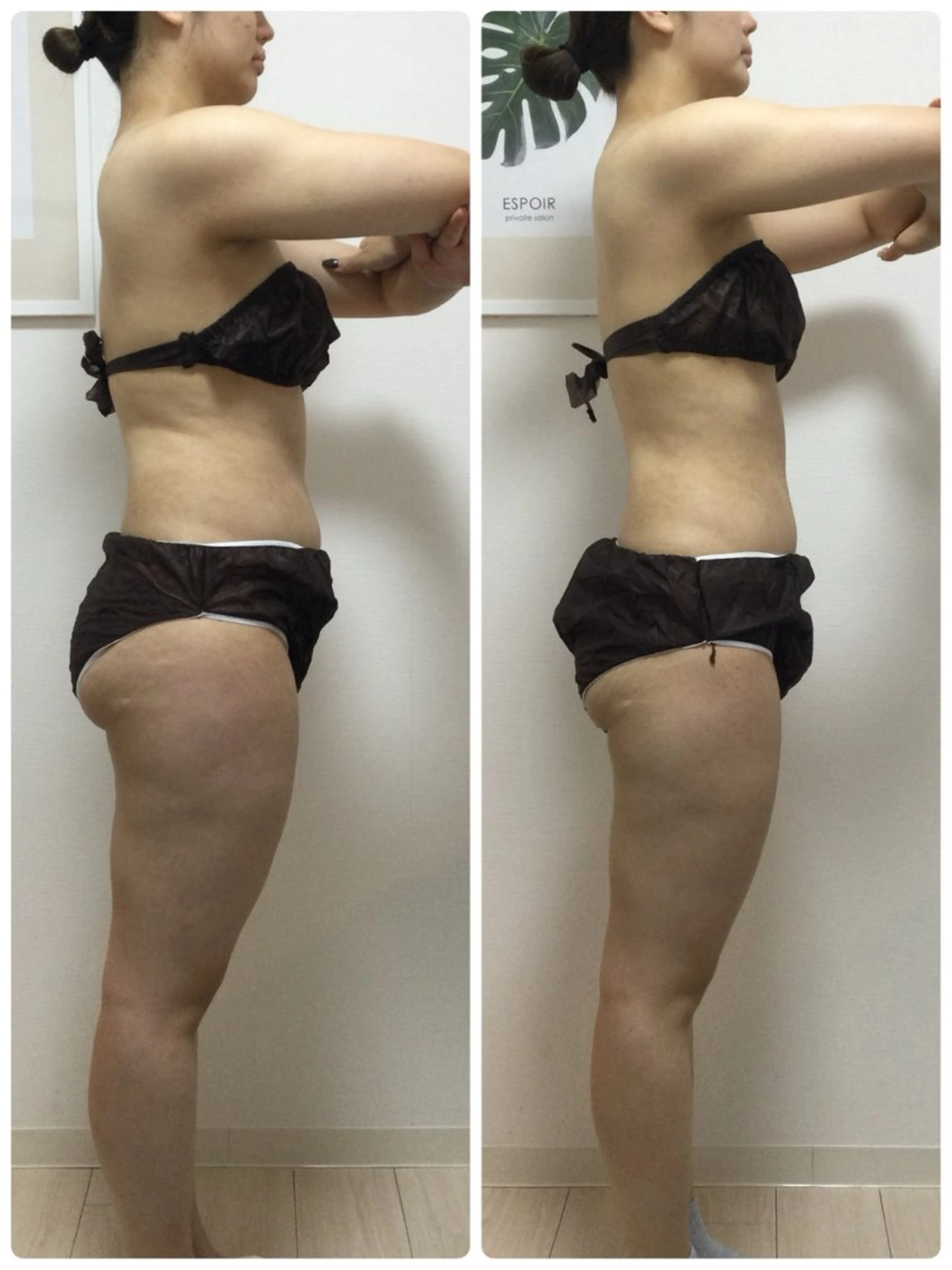 エステ リラク ESPOIR エスポワールのエステ・リラクイメージ