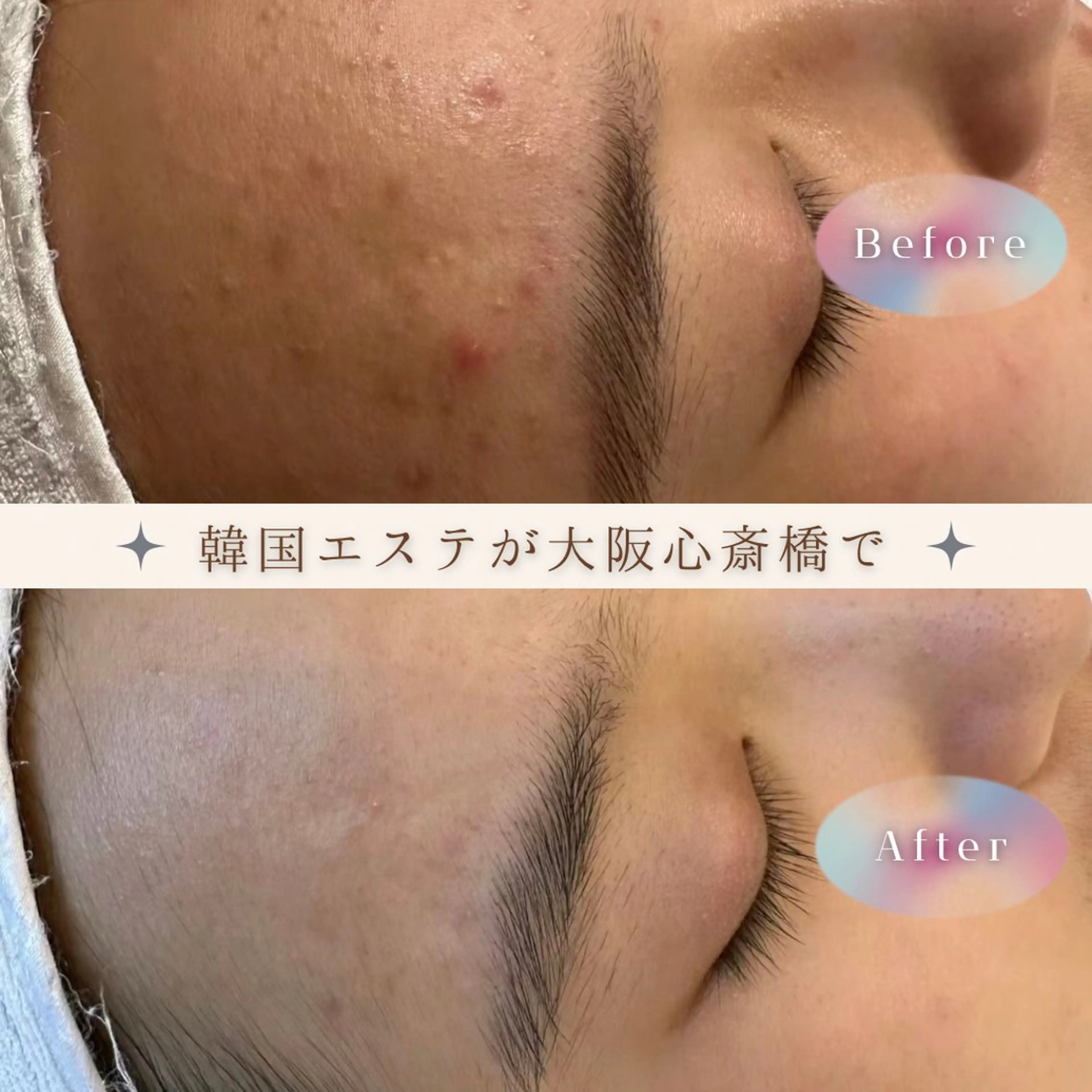 エステ リラク 愛維美水光美肌専門店所属・愛維美水光美肌専門店 メンズレディースokのエステ・リラクイメージ