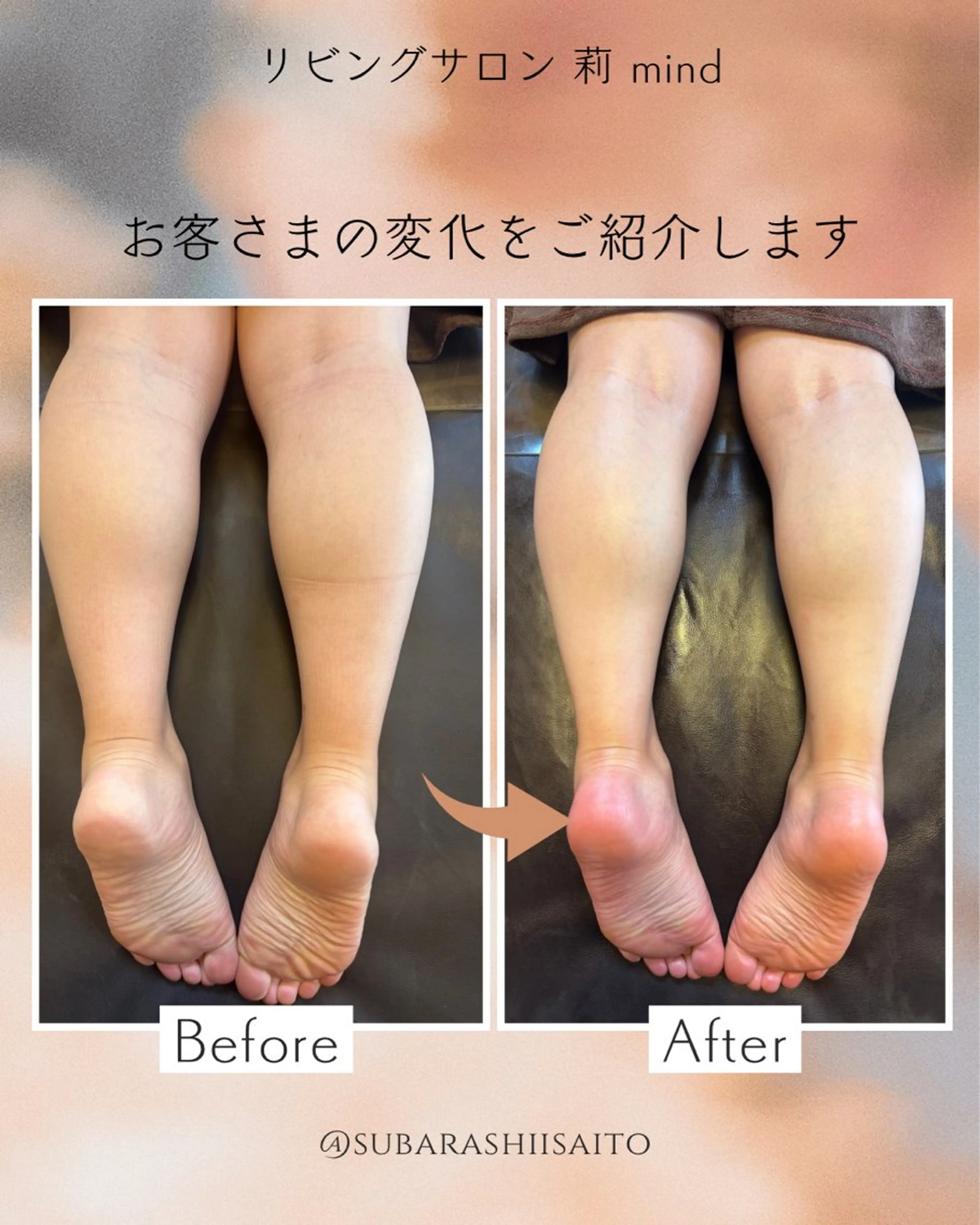 リラク リビングサロン 莉mindのエステ・リラクイメージ