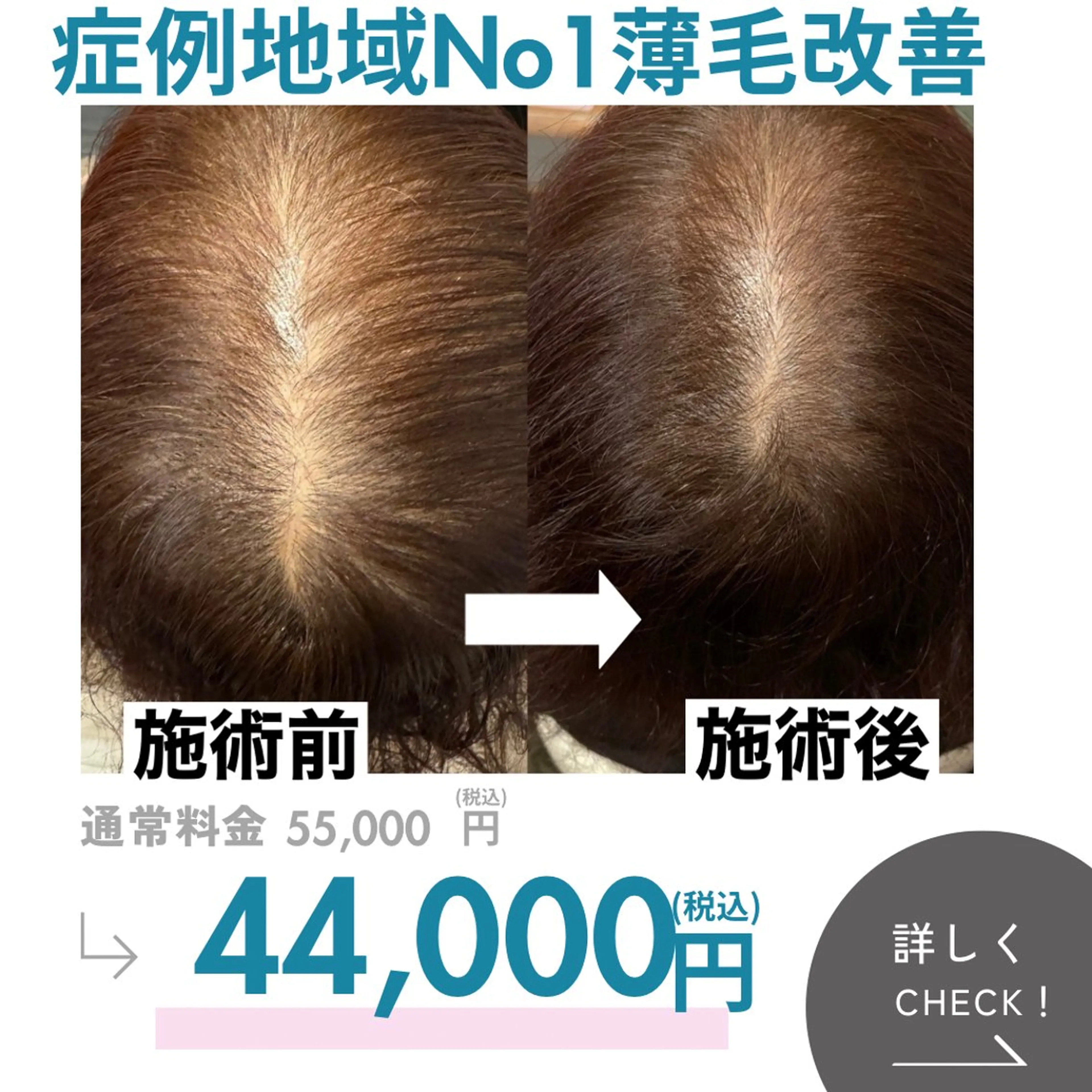 最速 毛穴シミ改善 いくえのその他イメージ