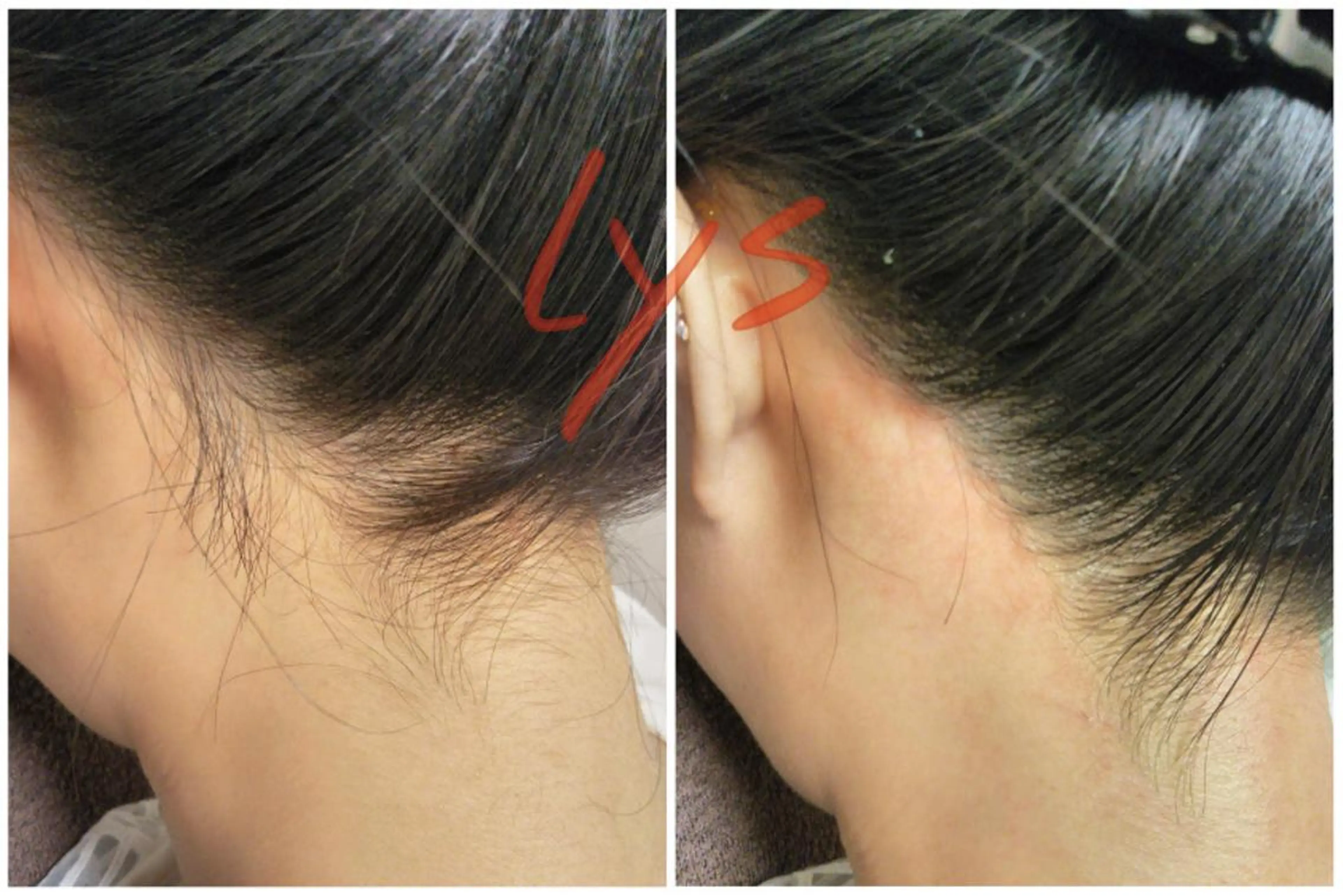 Lys所属・吉本 恭介のその他イメージ